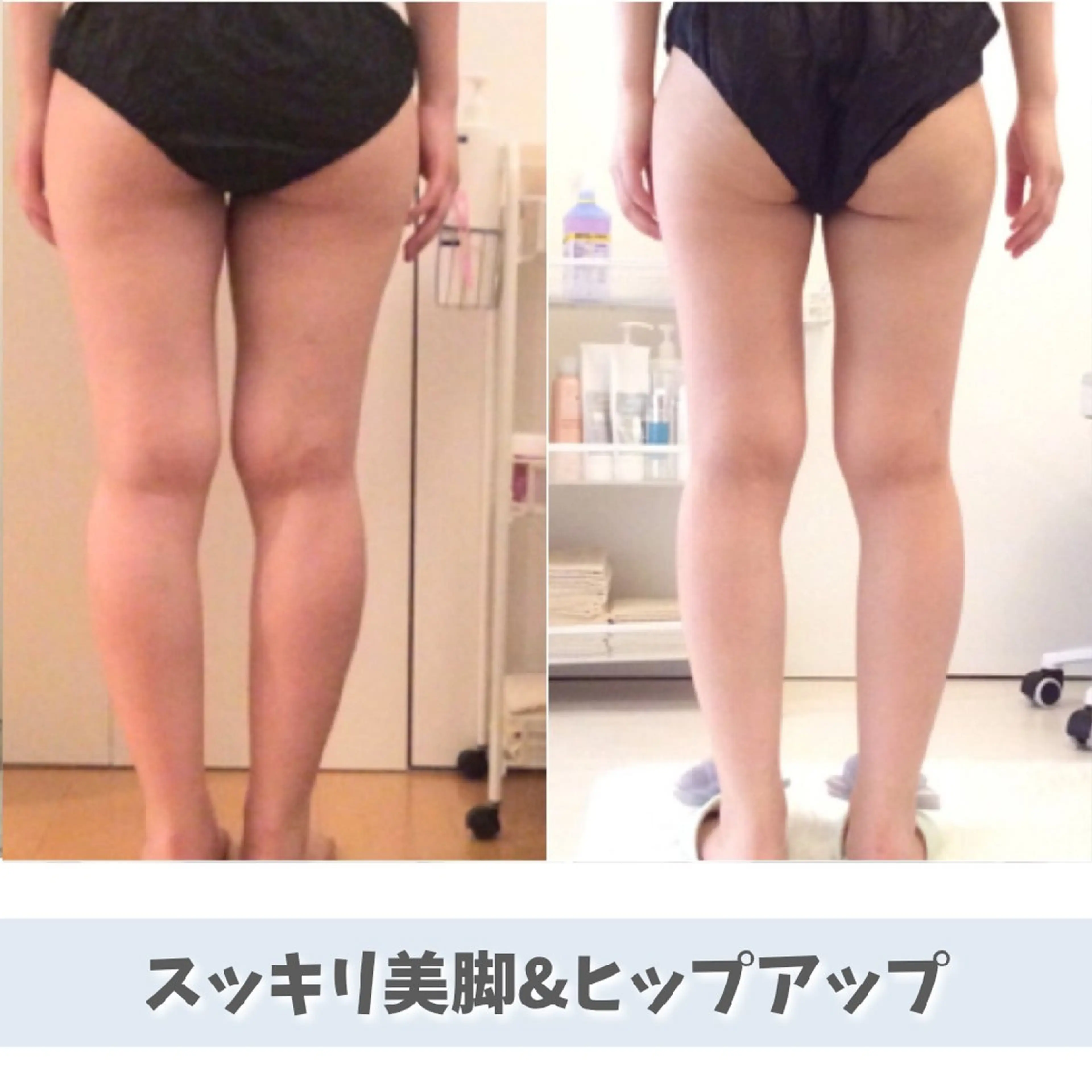 【ご新規様限定25%OFF】スッキリ美脚✨トリプル溶解痩身60分の写真