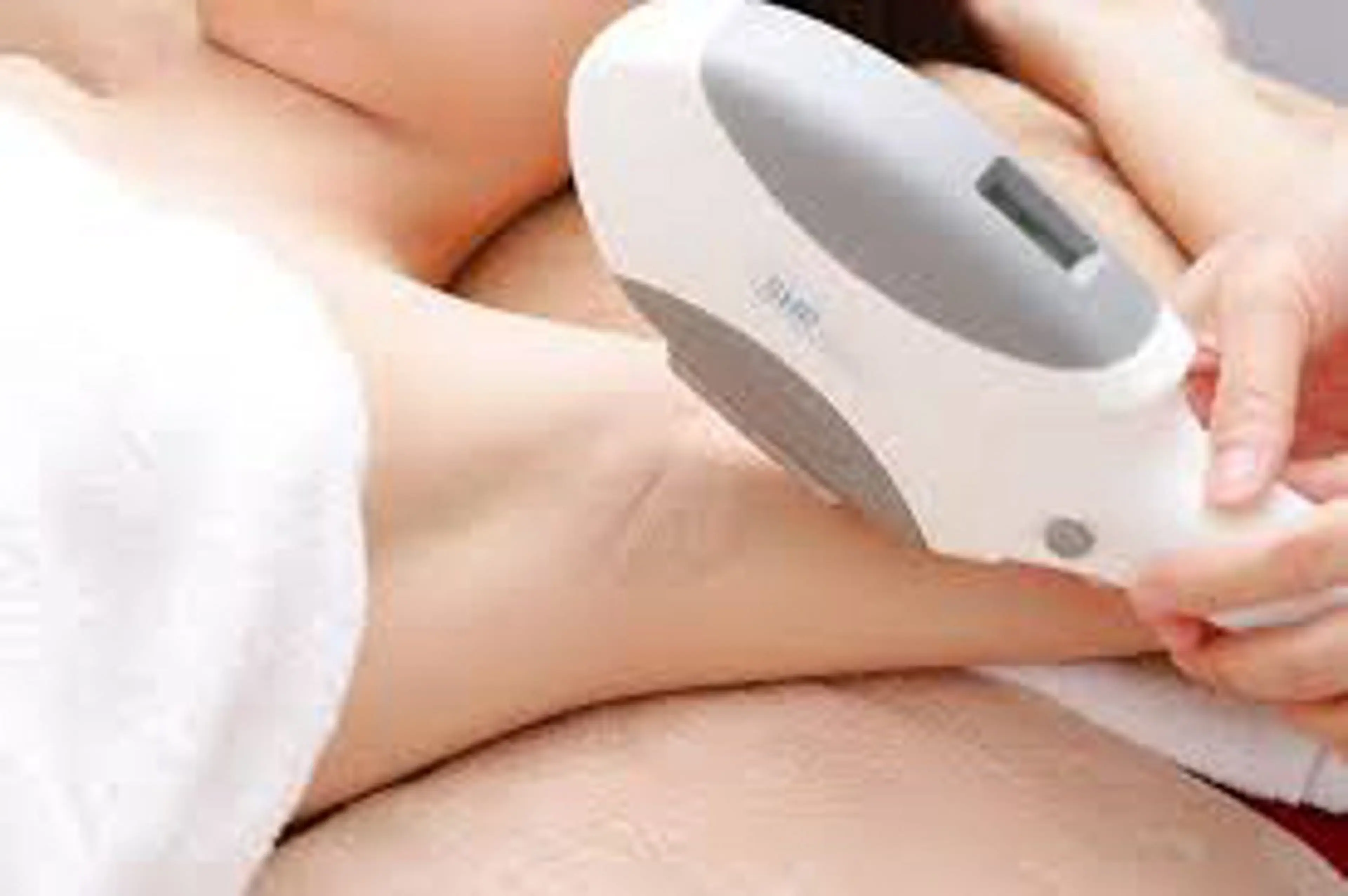 まずはお試しワキ脱毛!の写真