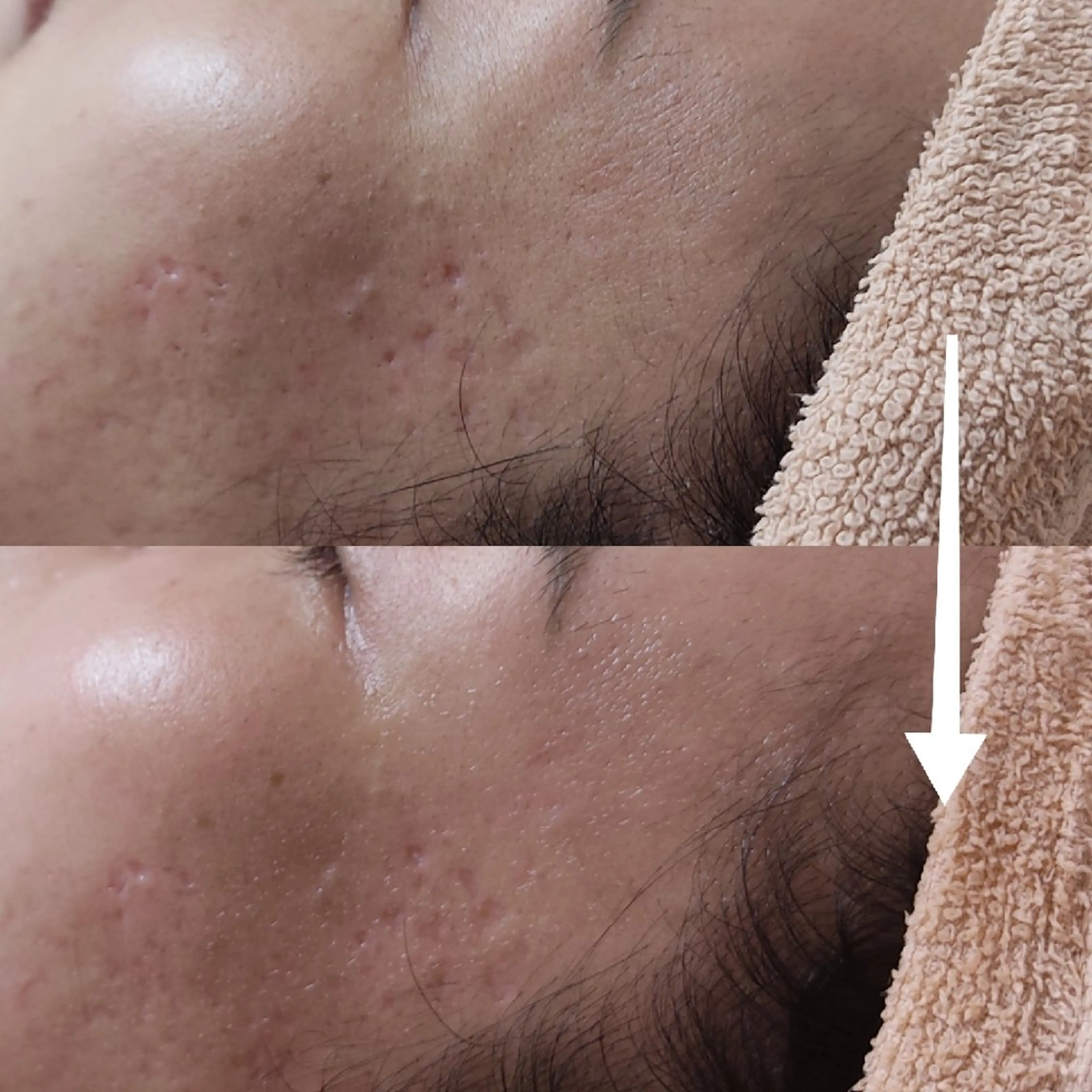 エステ リラク 山野愛子どろんこ美容〜Lough〜所属・山野愛子どろんこ美容 Laughのその他イメージ