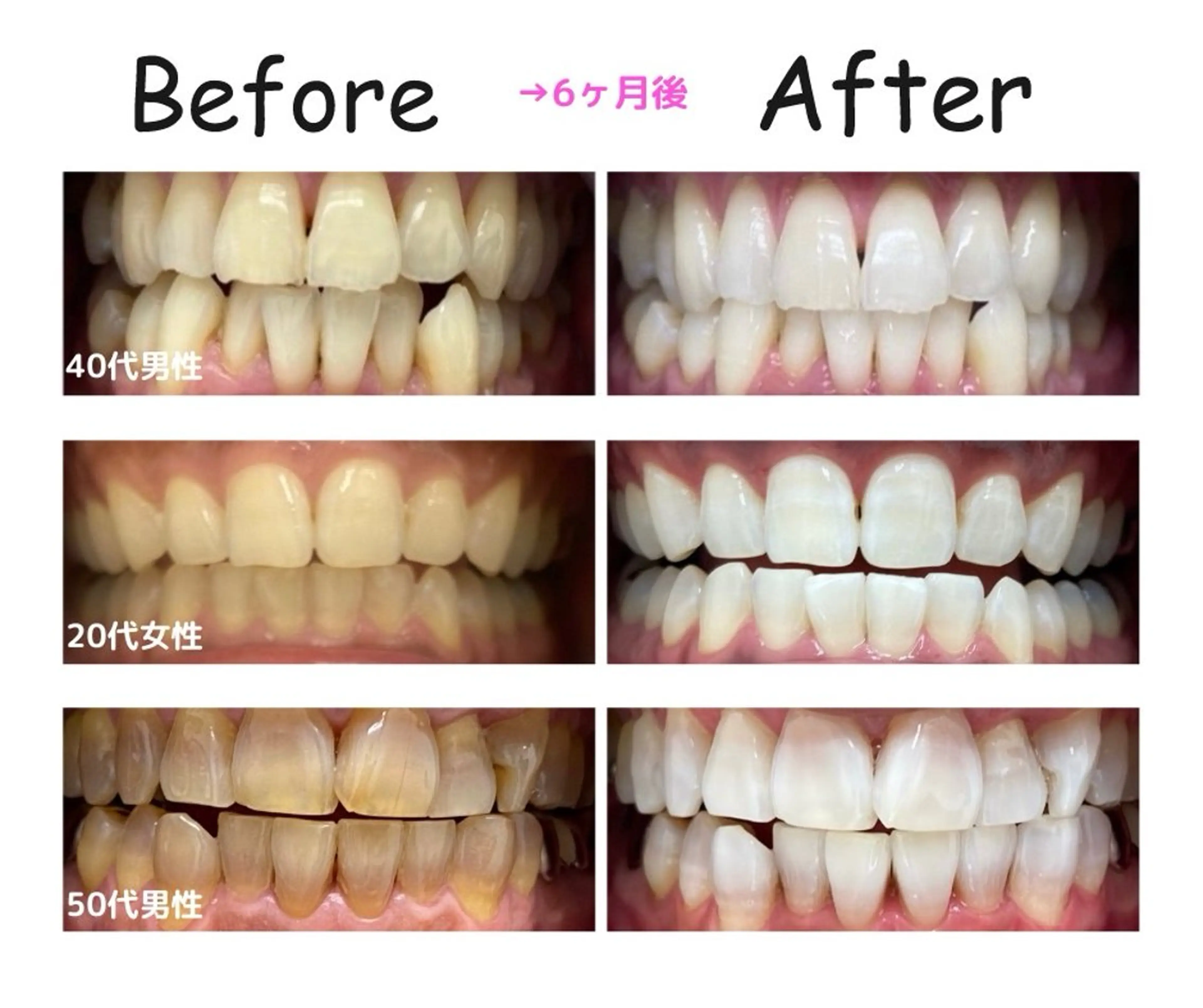 エクシアホワイトニング日本橋所属・エクシア ホワイトニング日本橋のその他イメージ