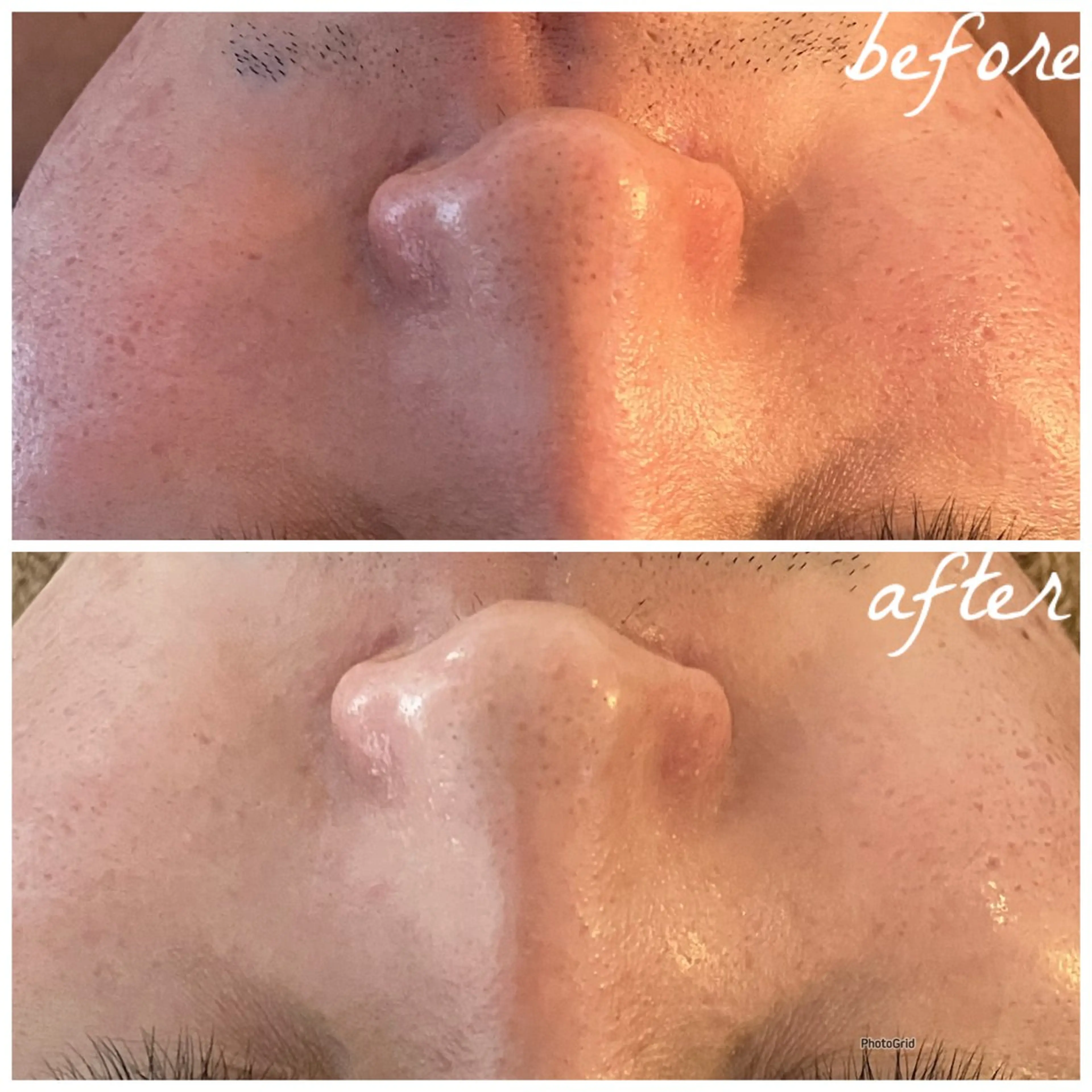 メンズ メナード岐阜茜部 杉浦のエステ・リラクイメージ