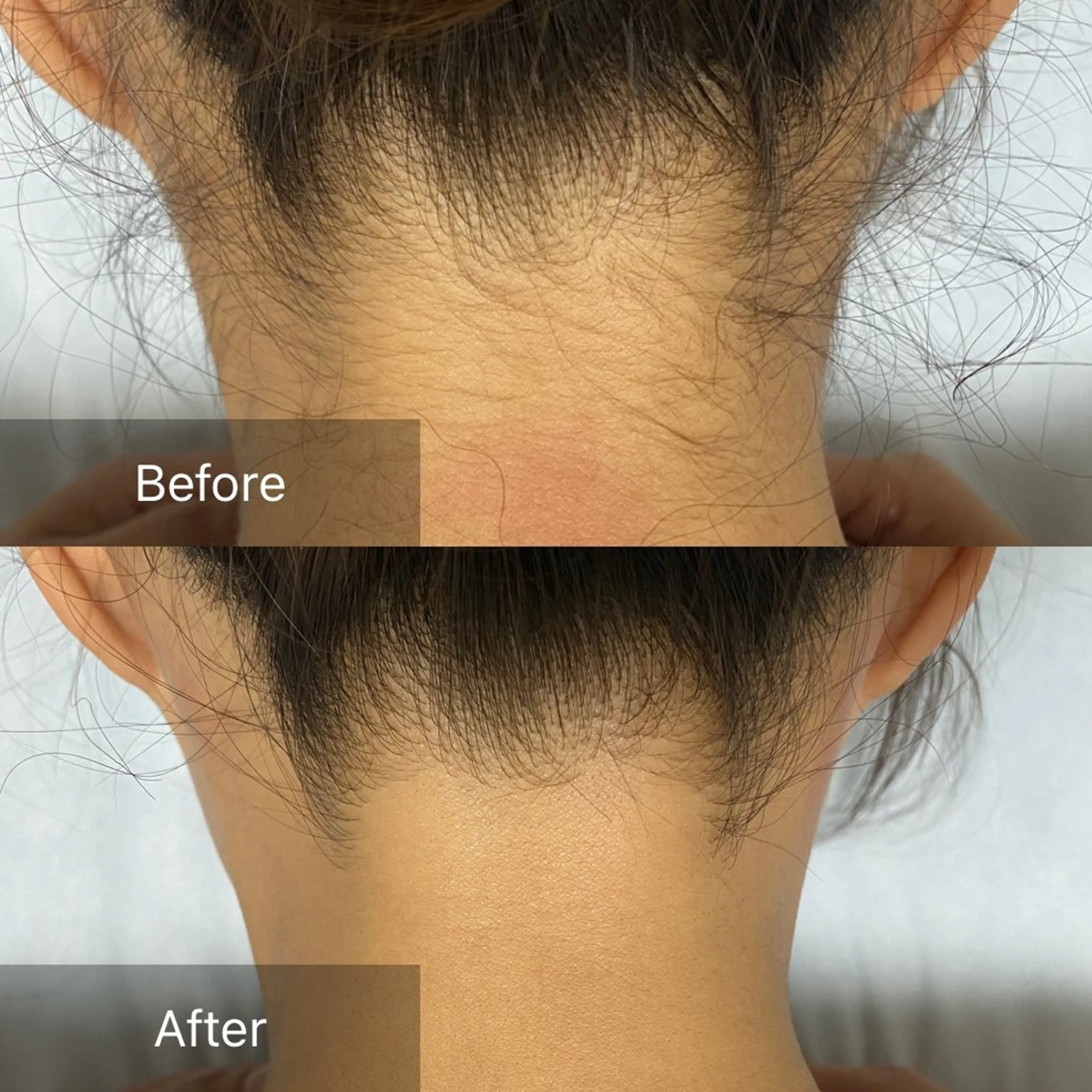 港区都度払い脱毛 miranjuのエステ・リラクイメージ