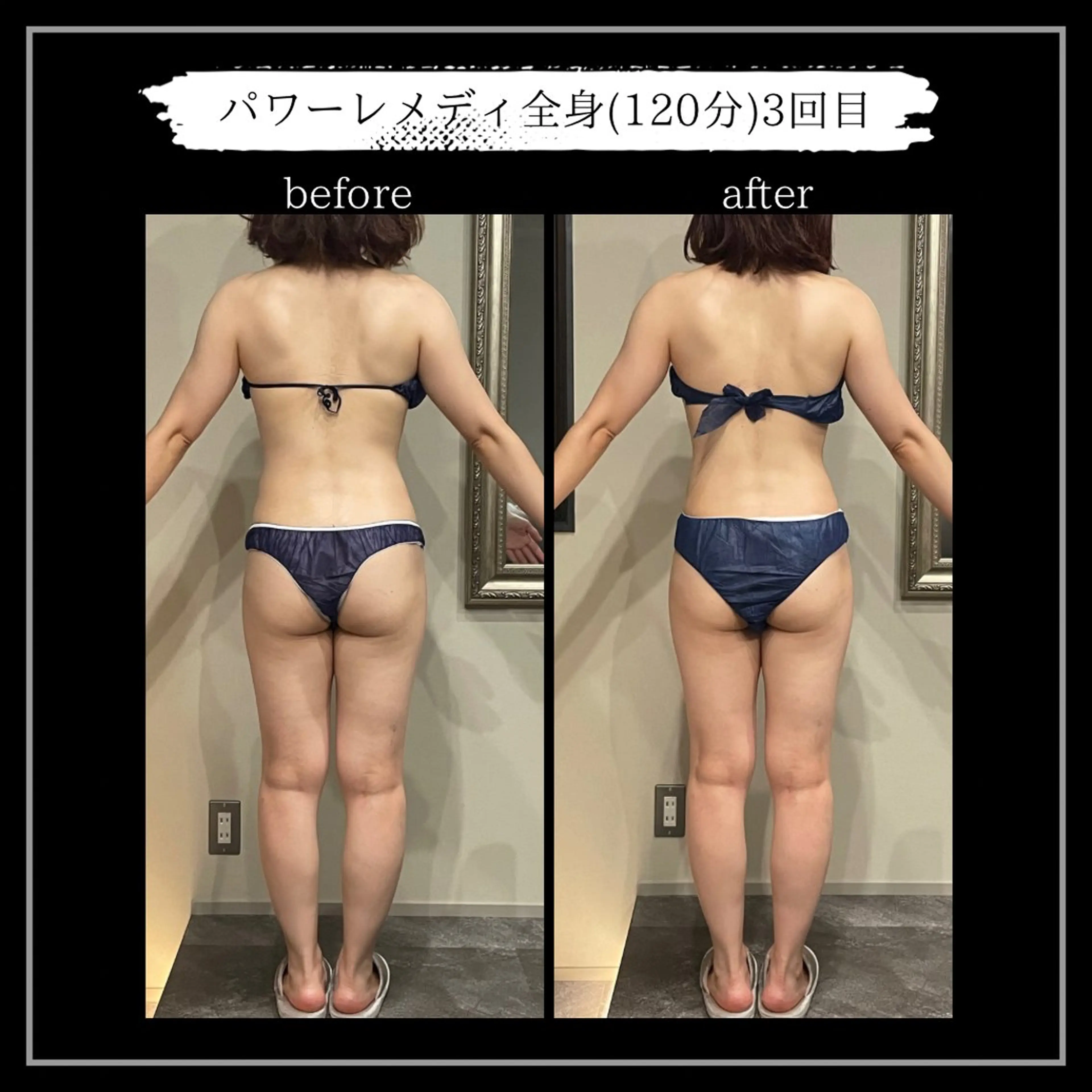 オフ:オン所属・オフ:オン 全身筋膜マッサージのエステ・リラクイメージ