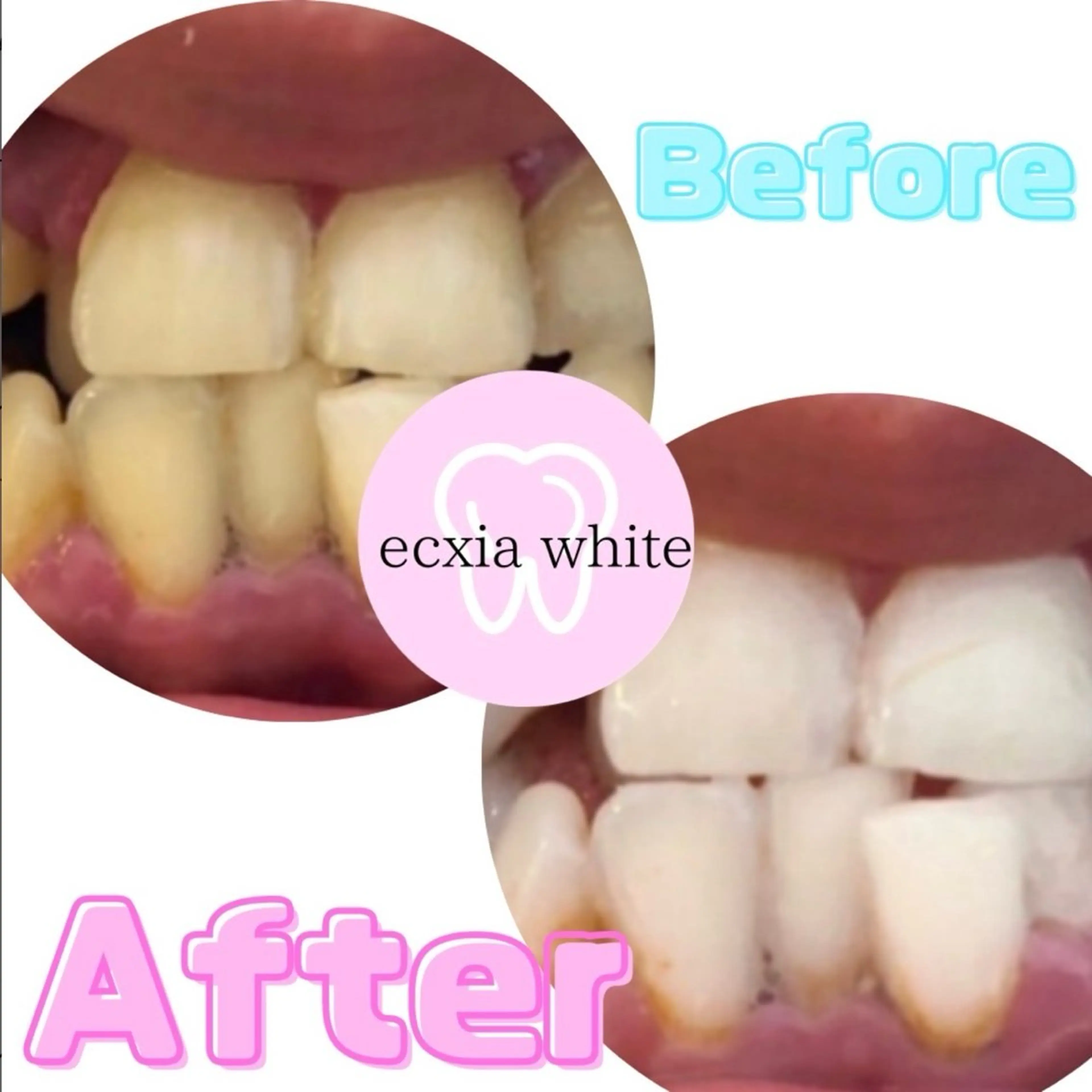 その他 セルフホワイトニングサロン  エクシアホワイト 王寺店所属・エクシア王寺 NISHIKAWAのその他イメージ