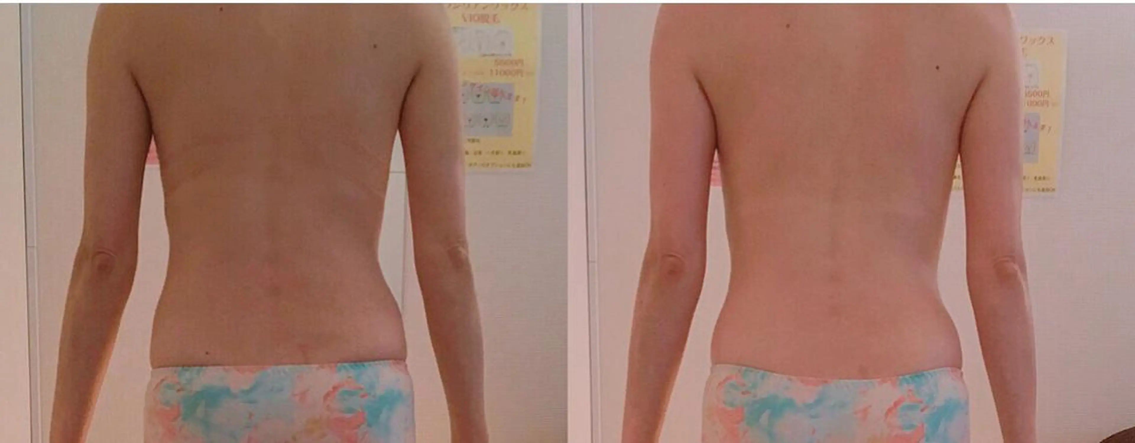 女性のお悩み美容 サロン　ヴィーナスのエステ・リラクイメージ