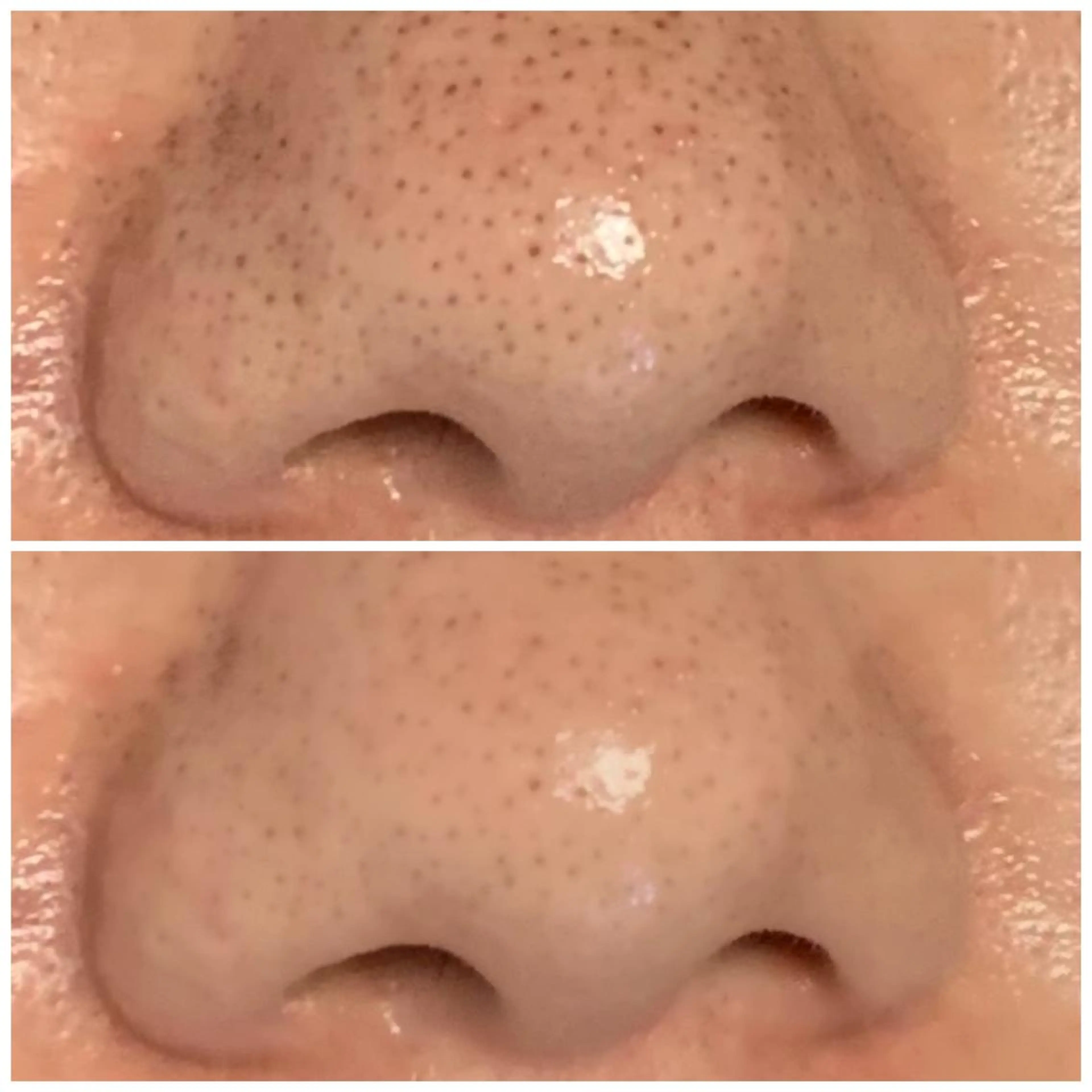 エステ リラク 透明感の肌Lino malieのエステ・リラクイメージ