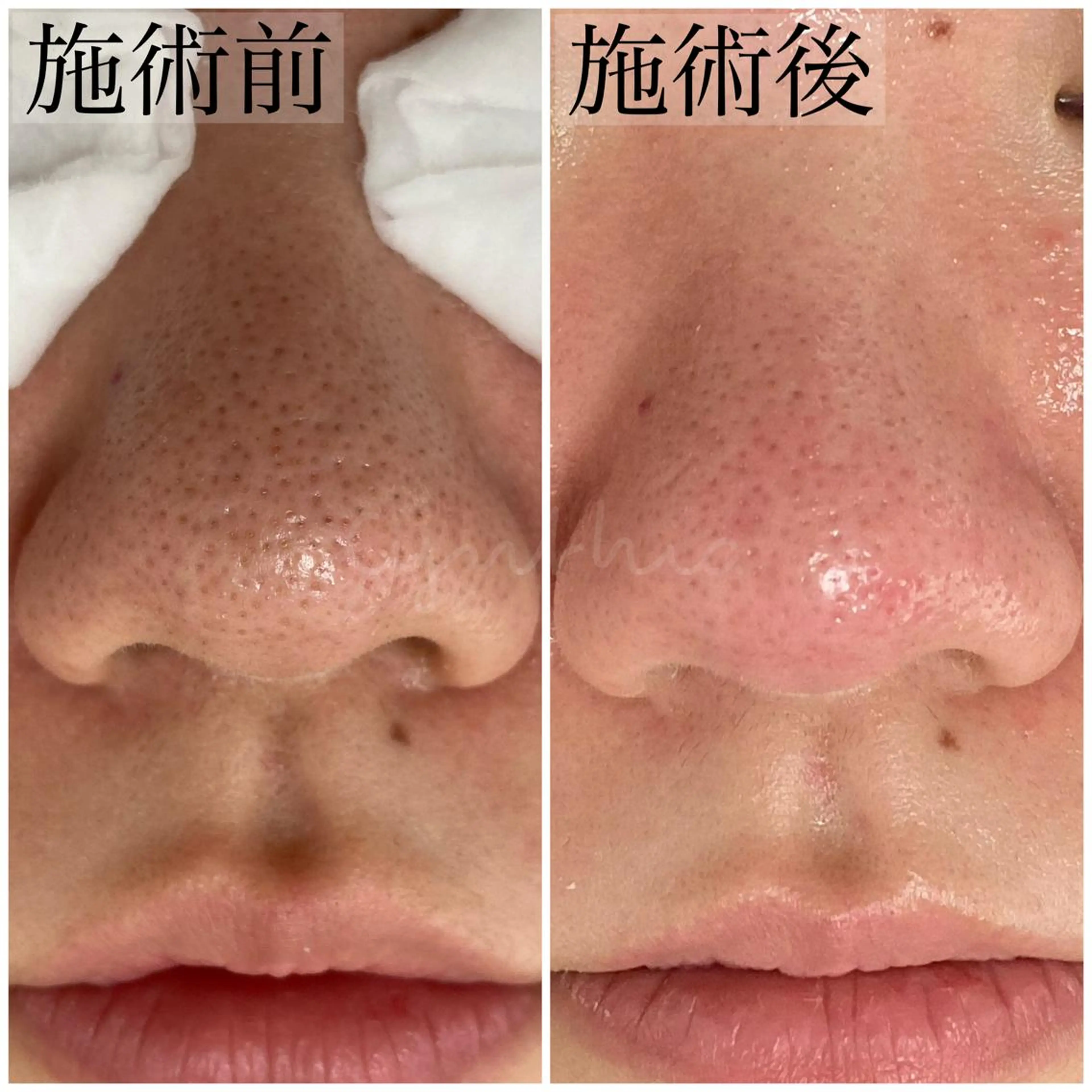 毛穴ケア専門店 Cynthiaのエステ・リラクイメージ