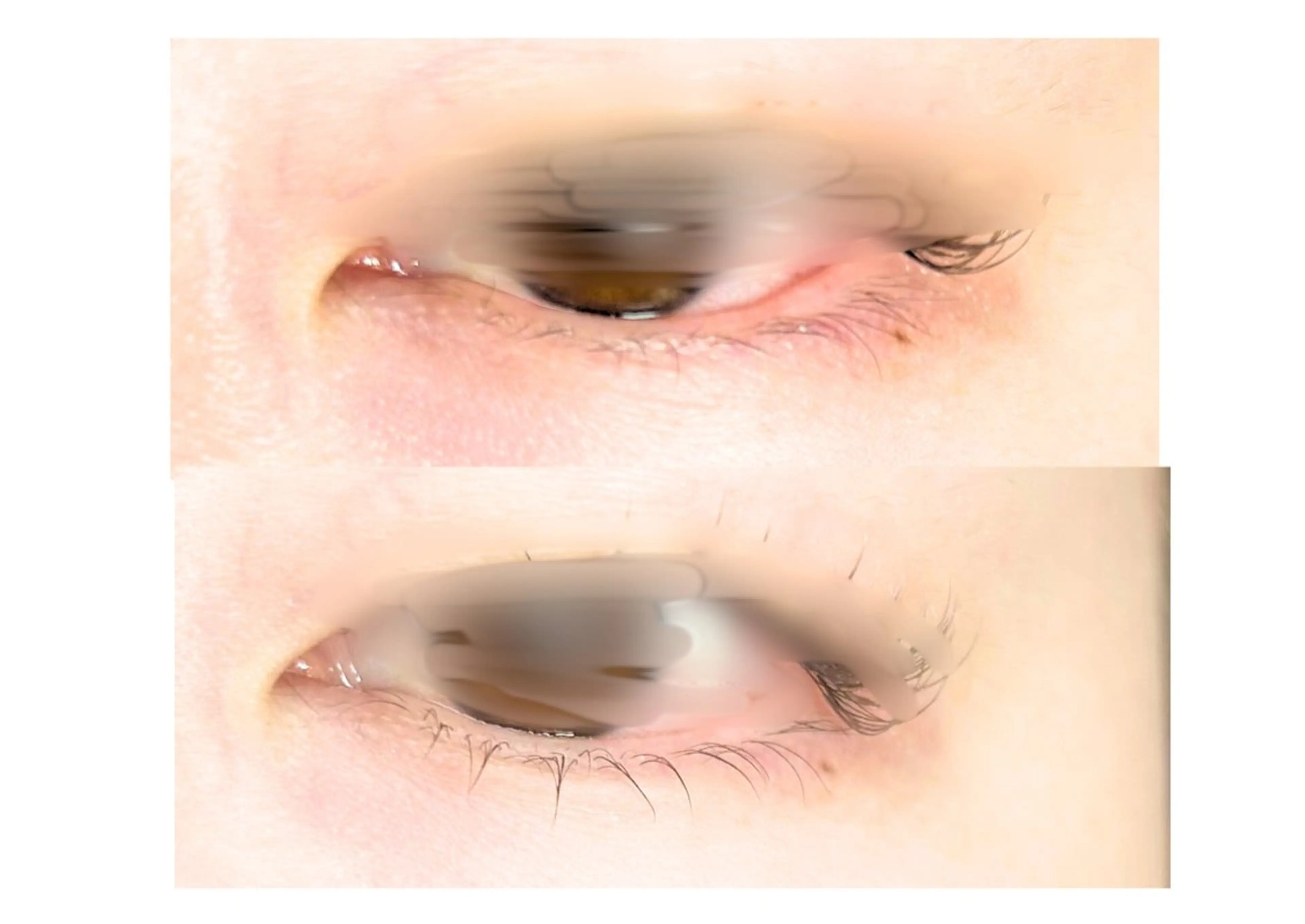 マツエク・マツパ 下まつげエクステ 一重×まつ毛パーマ マツパ エクラドゥボヌール所属・エクラドゥボヌール sakuraiのマツエク・マツパデザイン