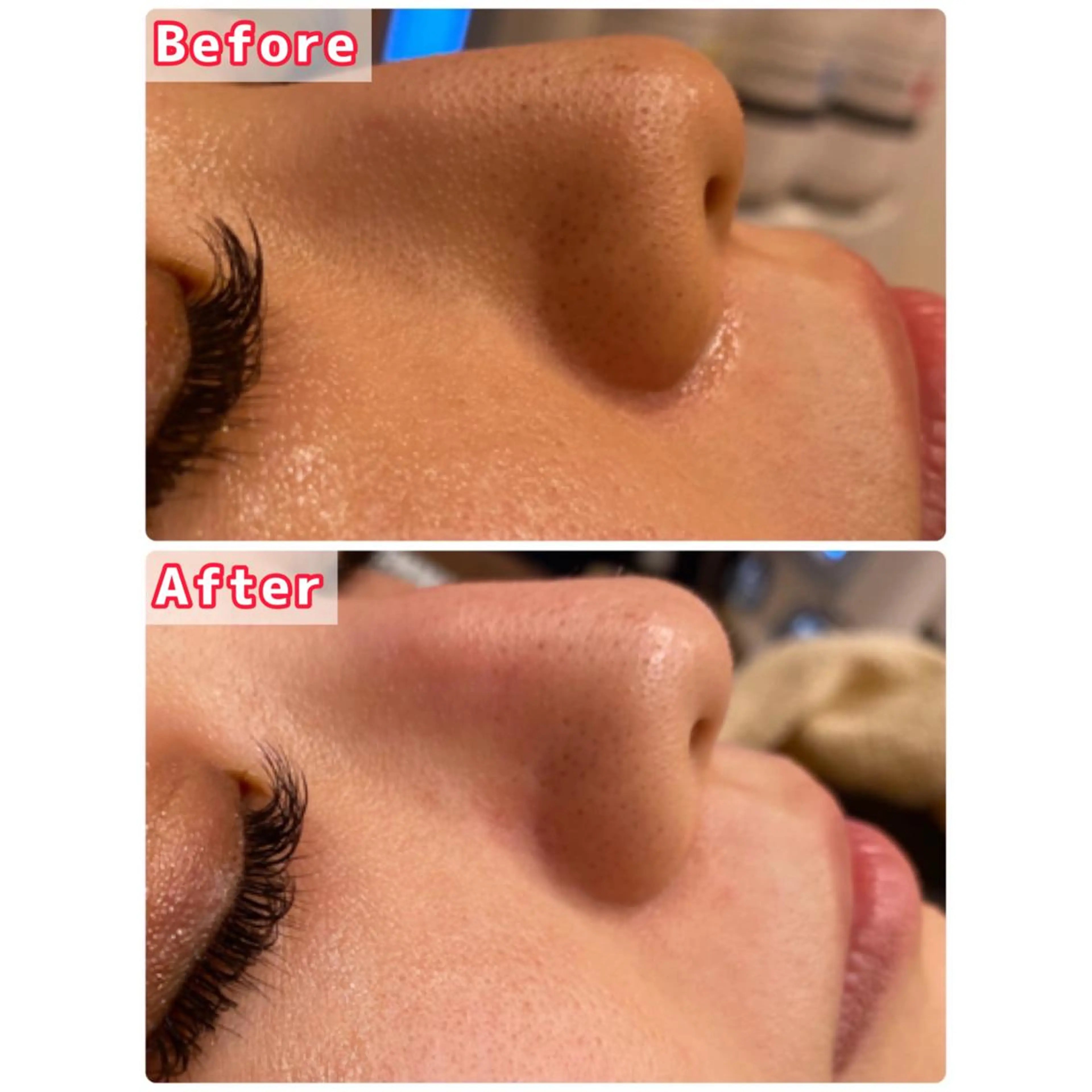 ハーブピーリング専門 muro.のエステ・リラクイメージ