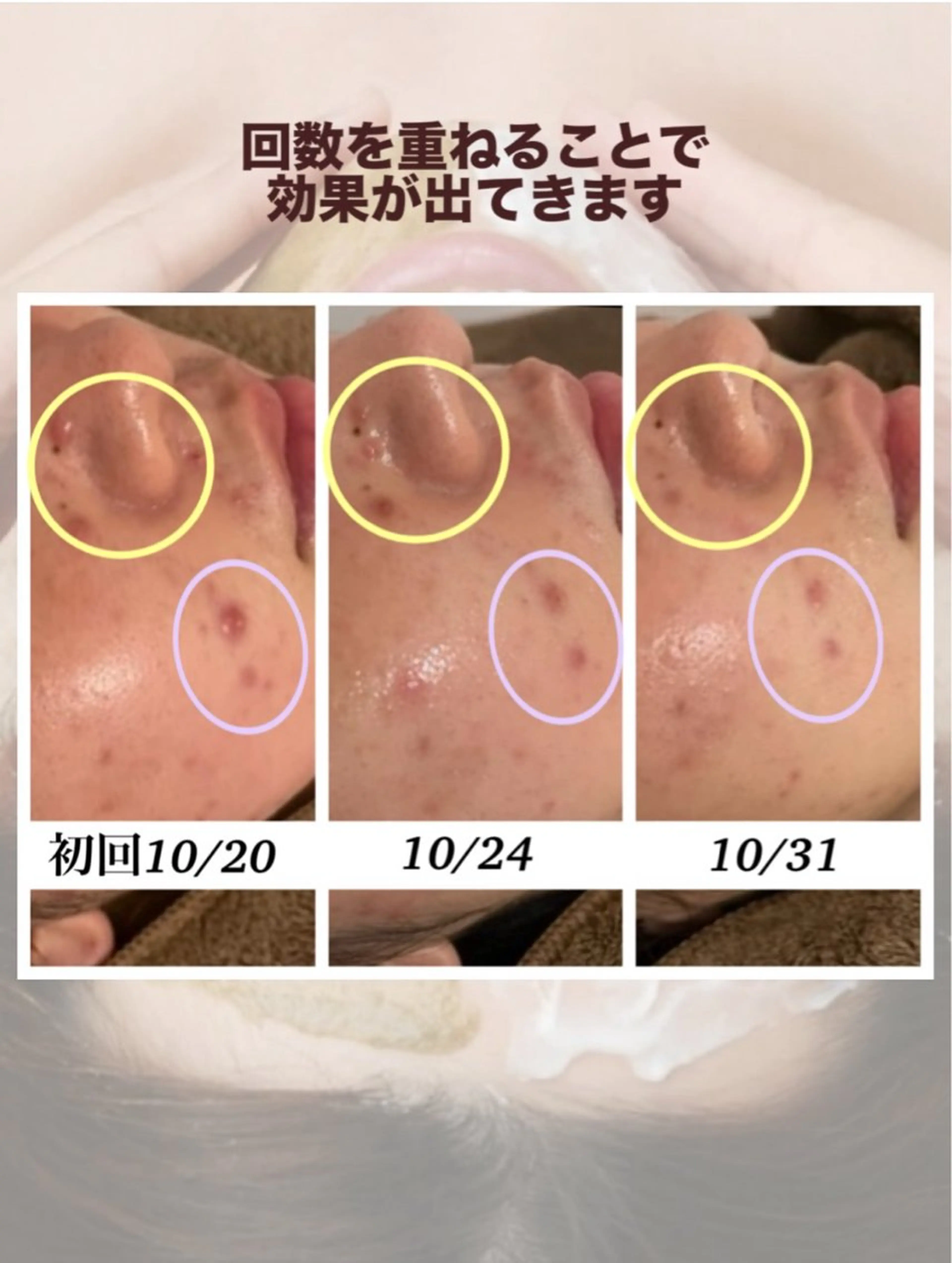 ベルーテ エッセンスのエステ・リラクイメージ