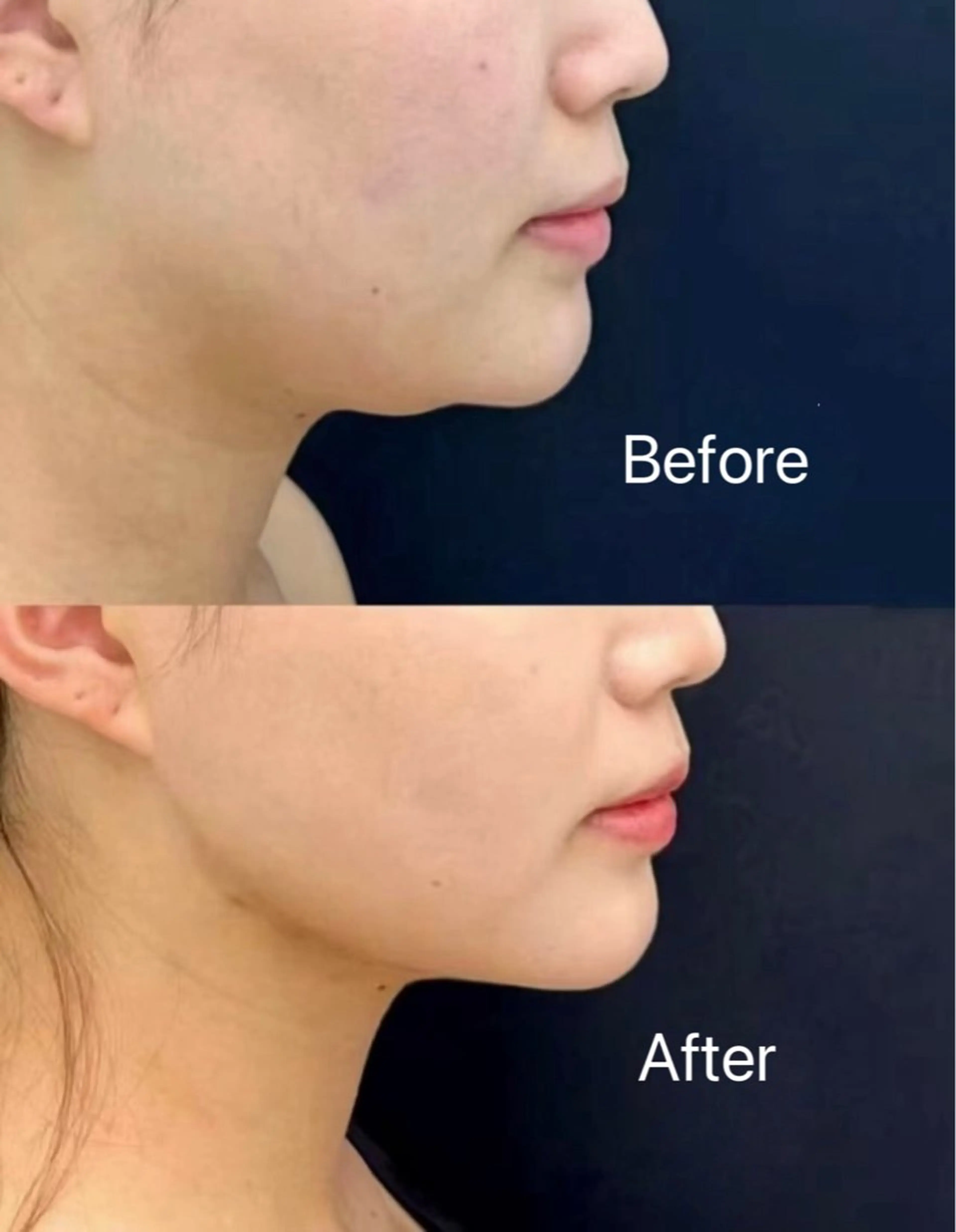 エステ 韓国式肌管理＆毛穴洗浄　THE ONE栄店所属・Theone 福本のエステ・リラクイメージ