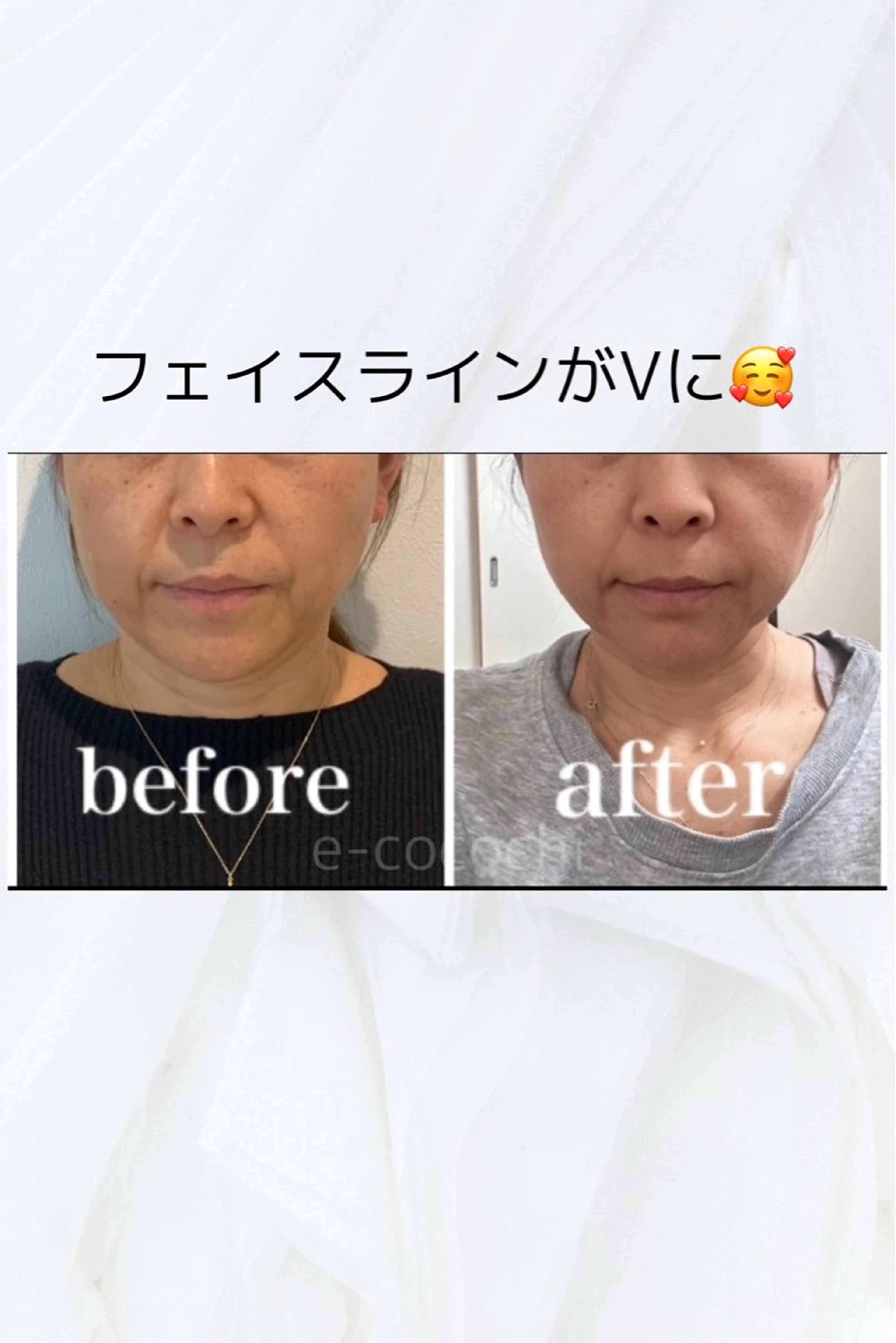 エステ リラク 小顔と ヘッドスパのお店のエステ・リラクイメージ