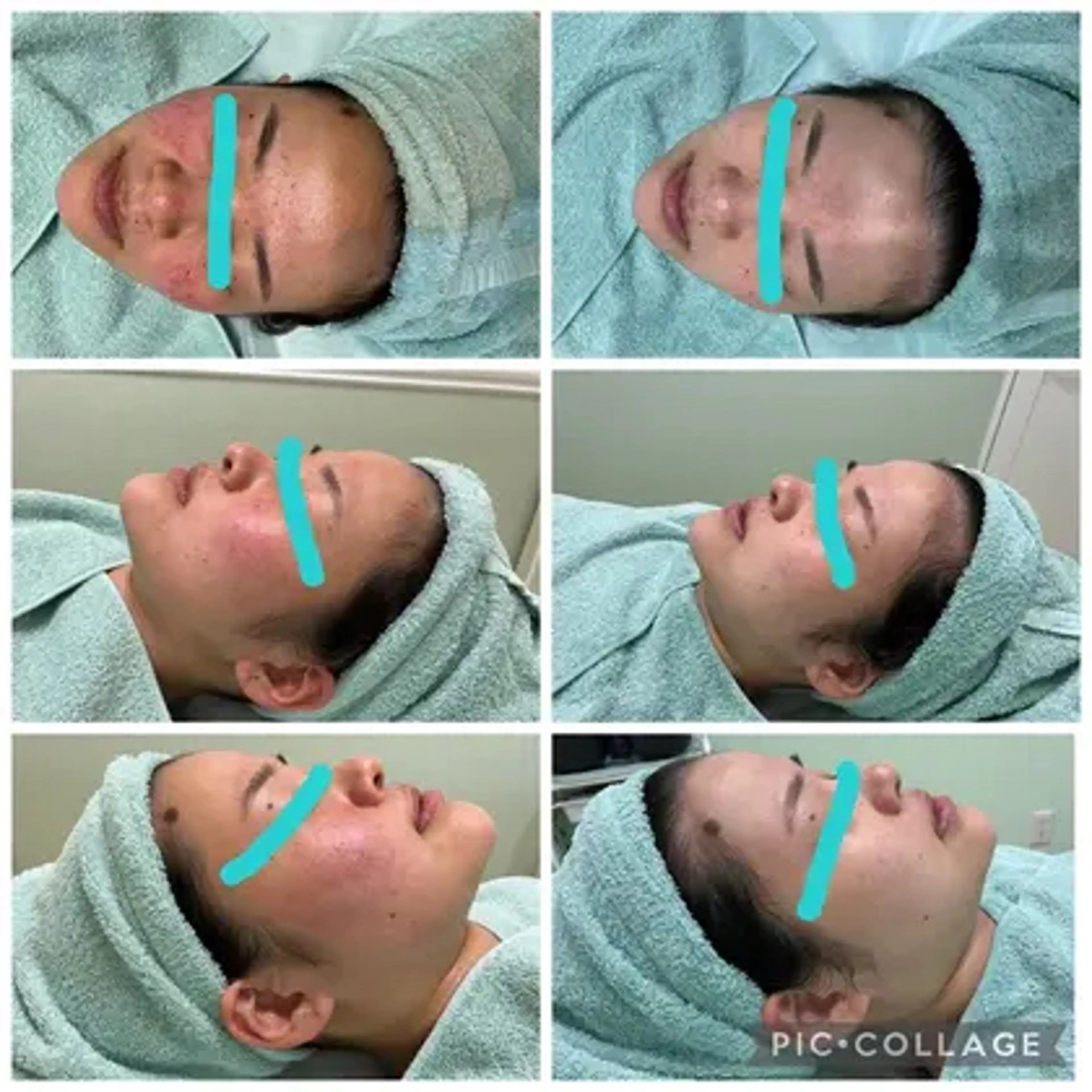 脱毛＆フェイシャル MIEUX心斎橋店のエステ・リラクイメージ