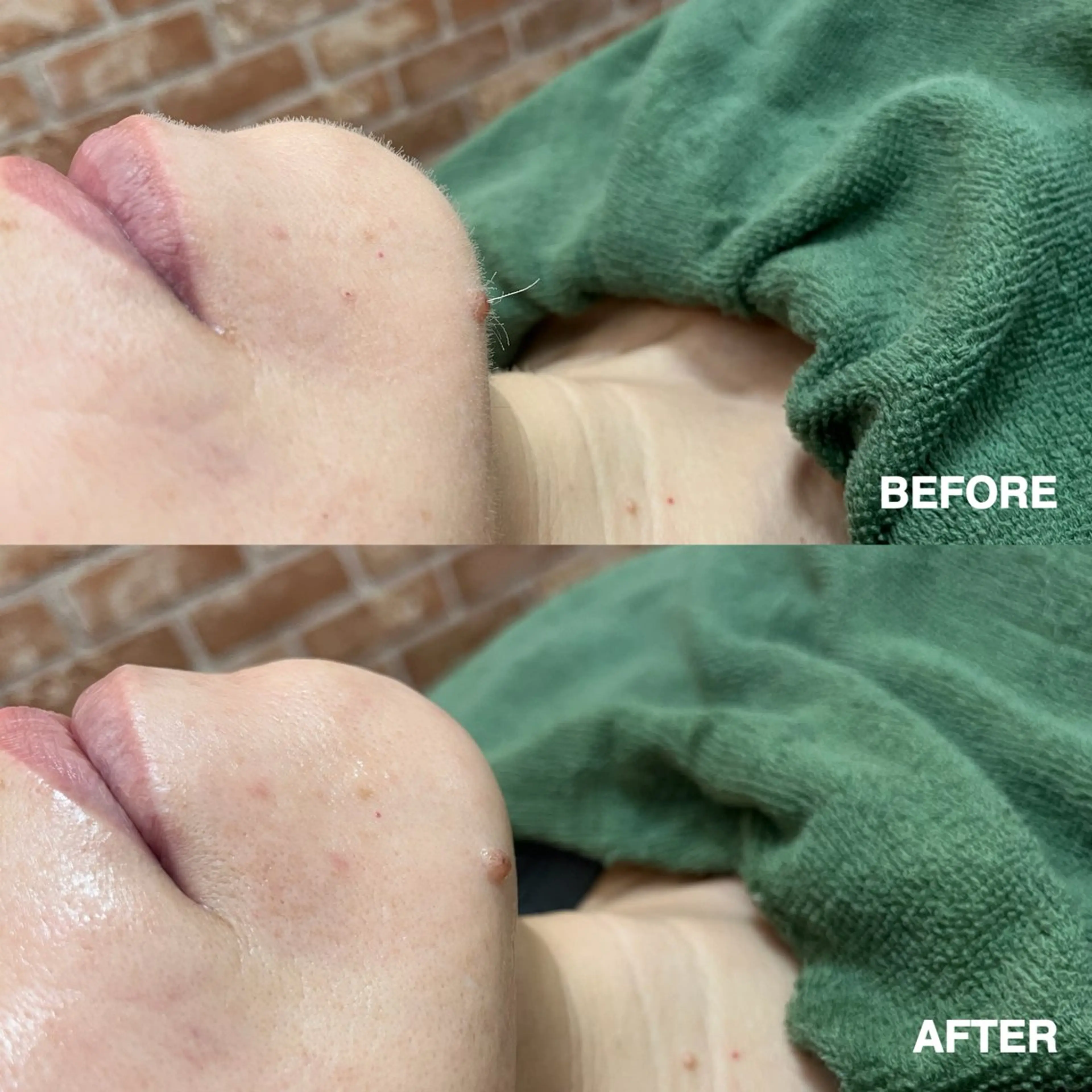 【リラックスコース】※シェービング込の写真