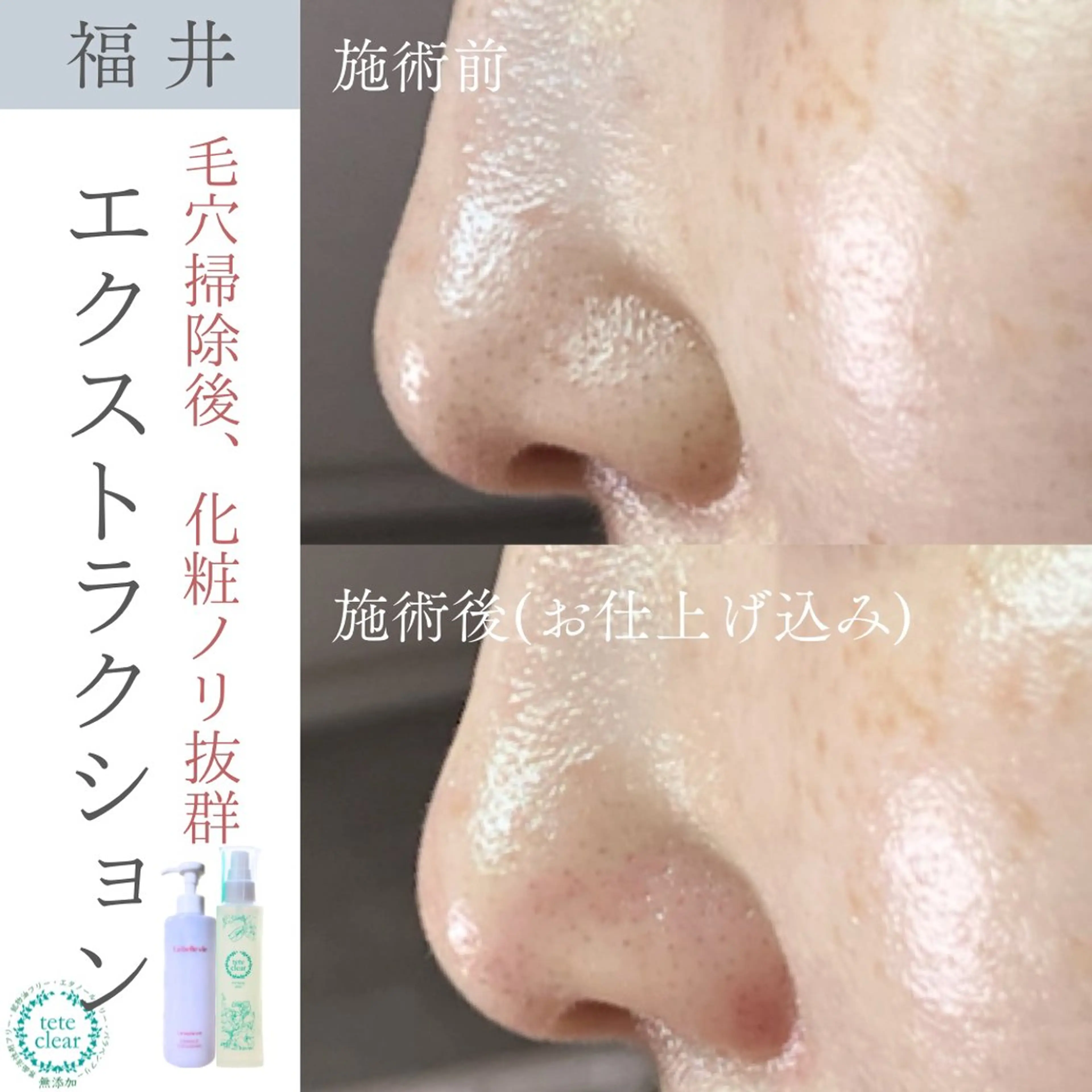 毛穴肌質ケアサロン Yourmeユアミーのエステ・リラクイメージ