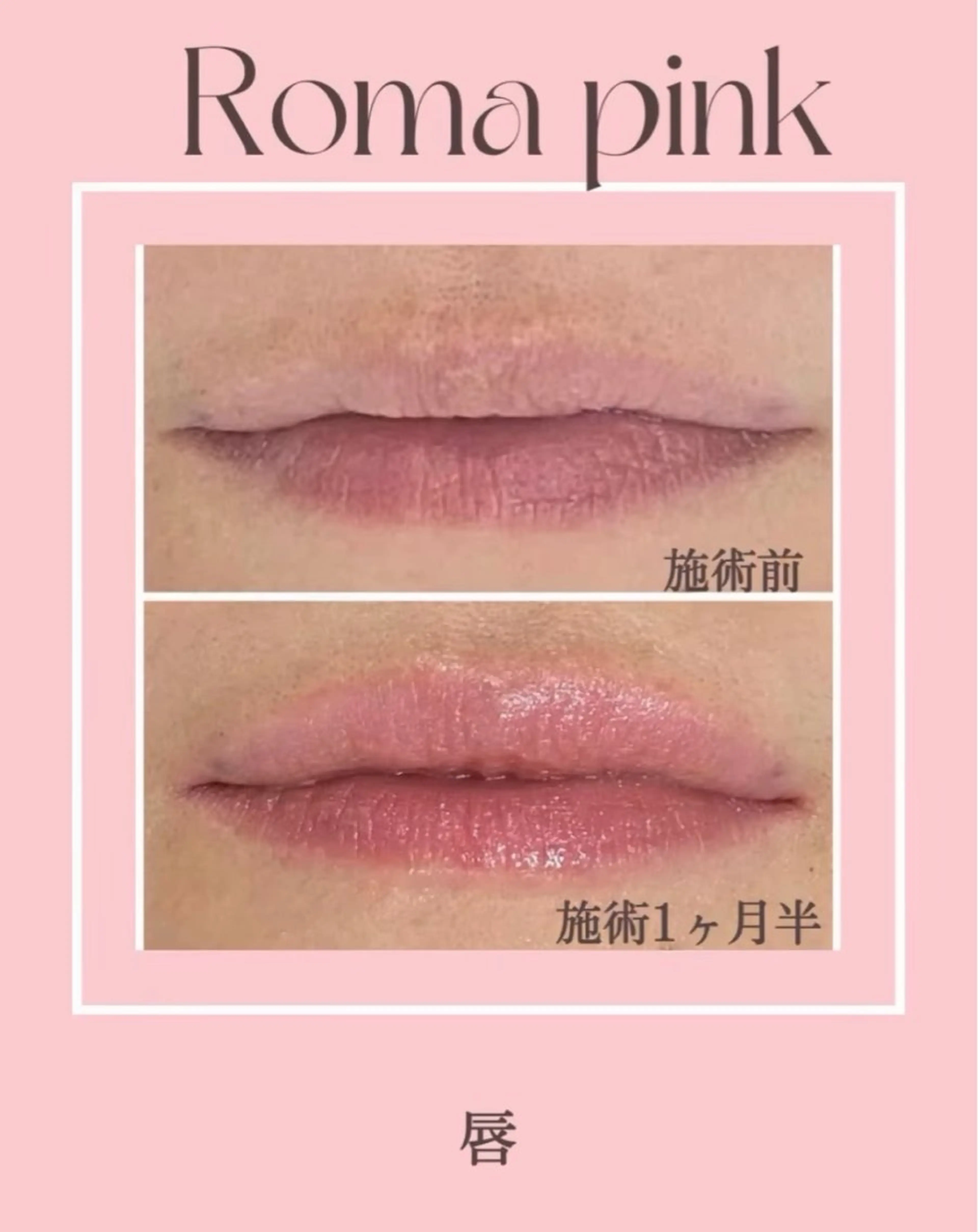 LiLL by Andre beauty所属・LiLL 熊本のその他イメージ