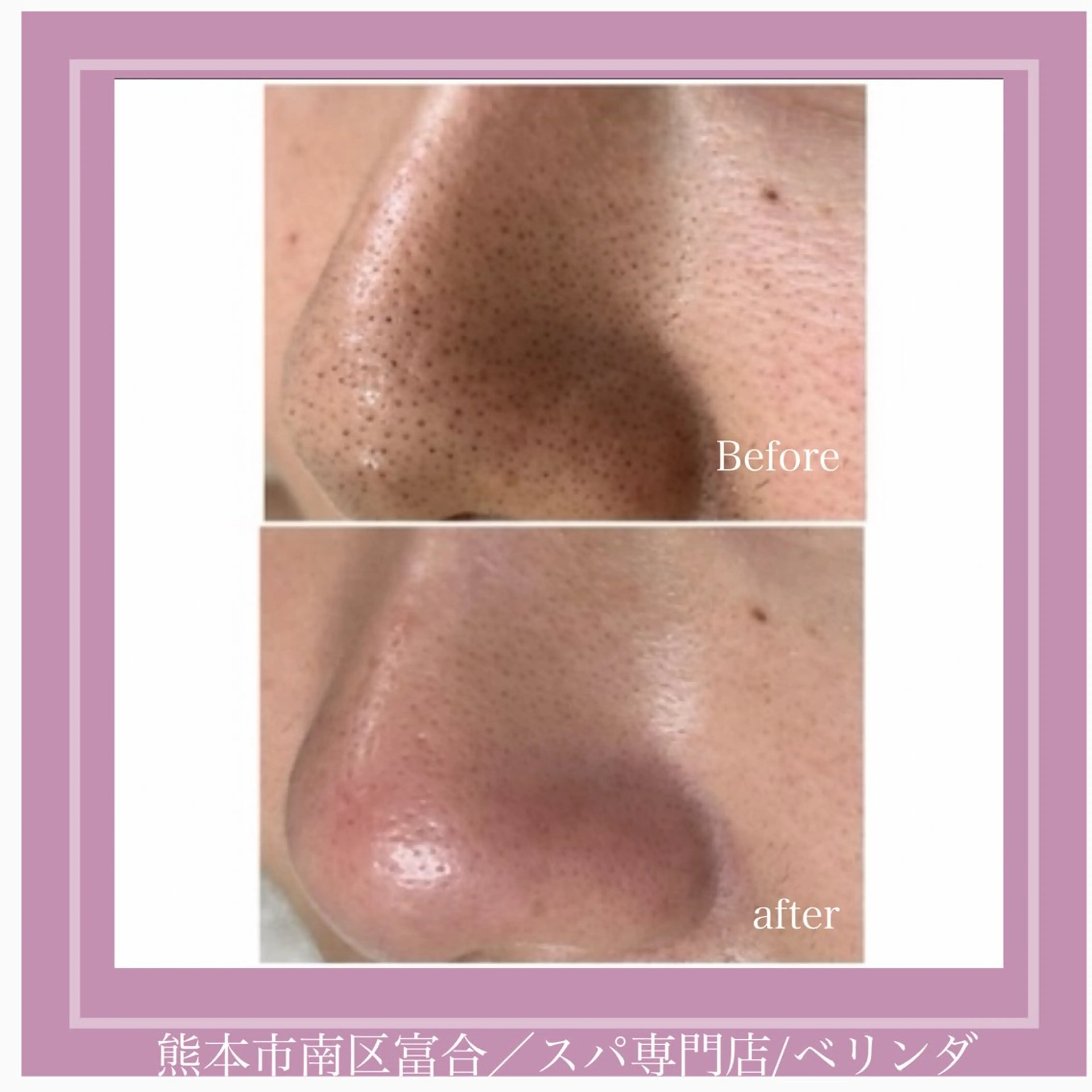 BELINDA HITOMIのマツエク・マツパデザイン