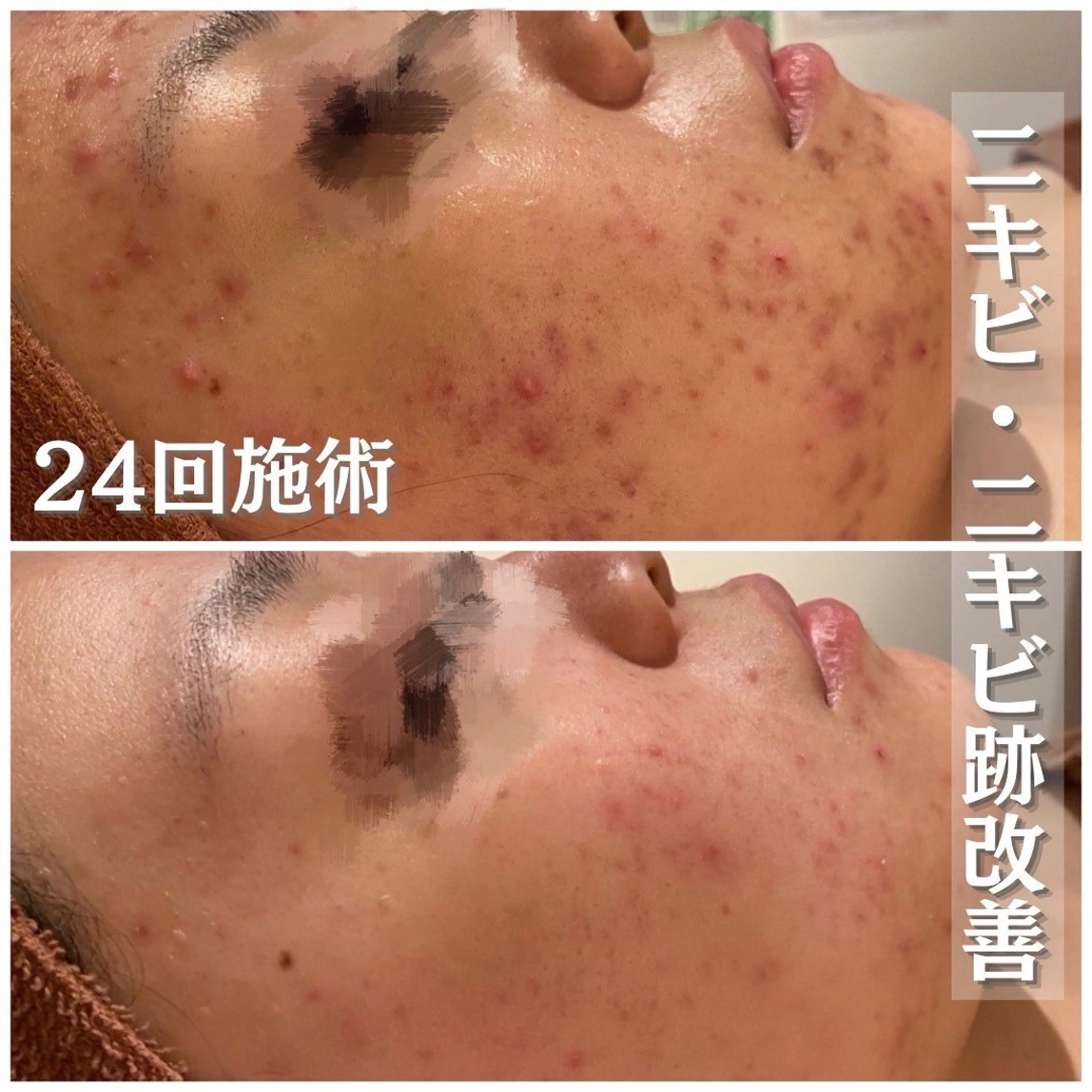 ニキビ・肌質改善専門 ♡人生が変わるサロンのエステ・リラクイメージ