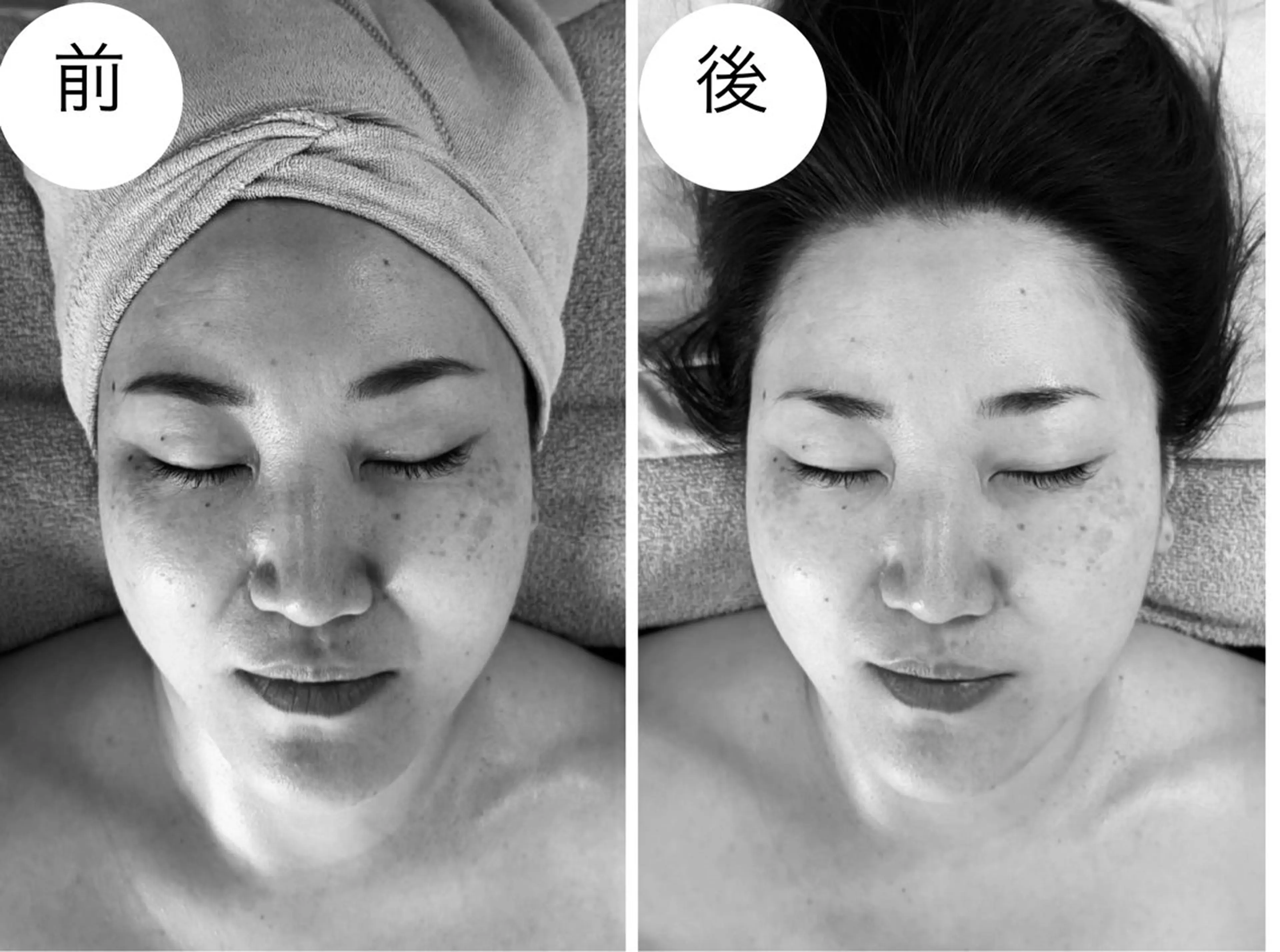 エステ MiEL  total beaty salon所属・肌質改善サロン ナツコのエステ・リラクイメージ