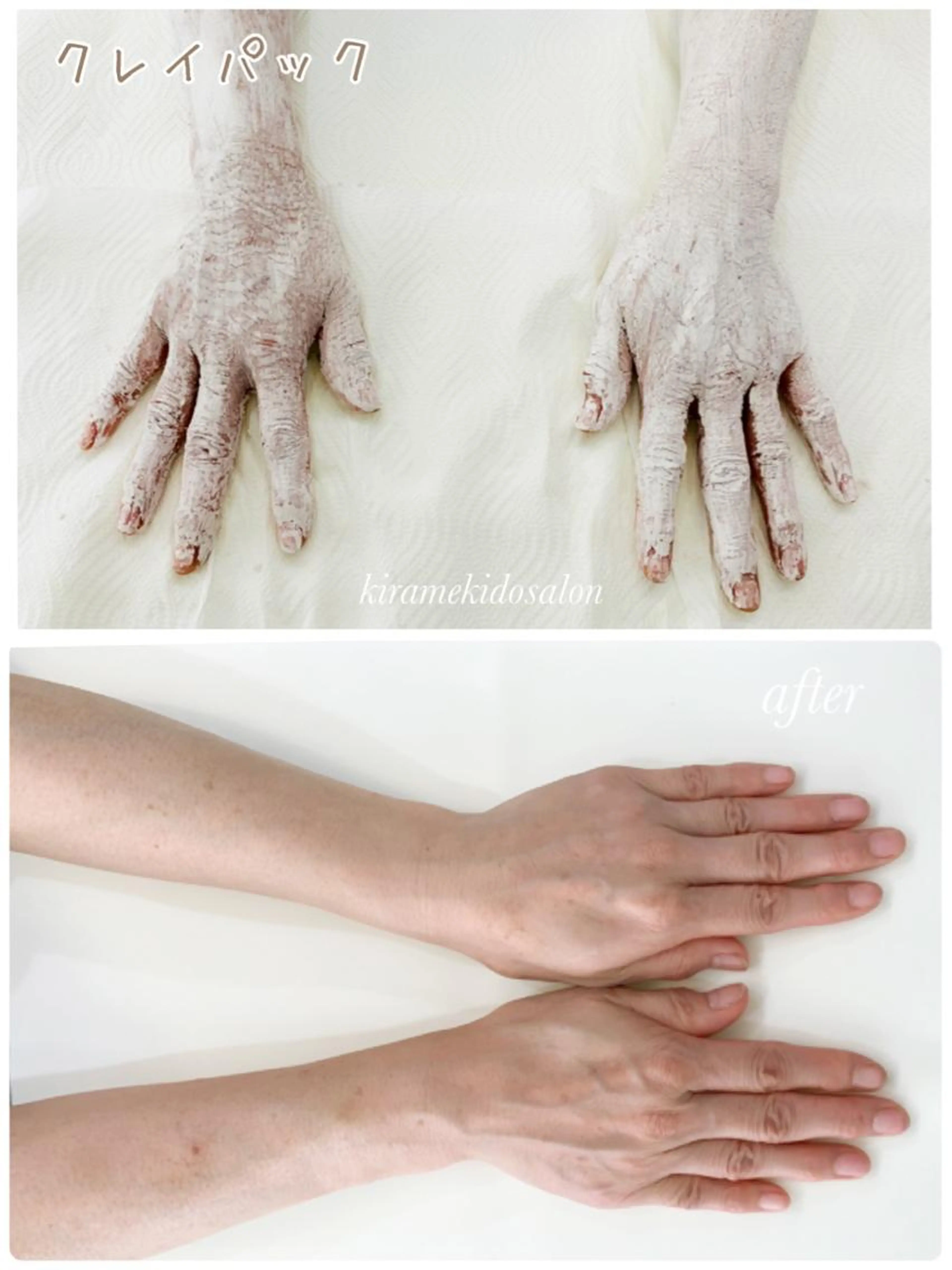 hand クレイパック＋マッサージ　（手首まで）1500円　　肘まで2500円の写真