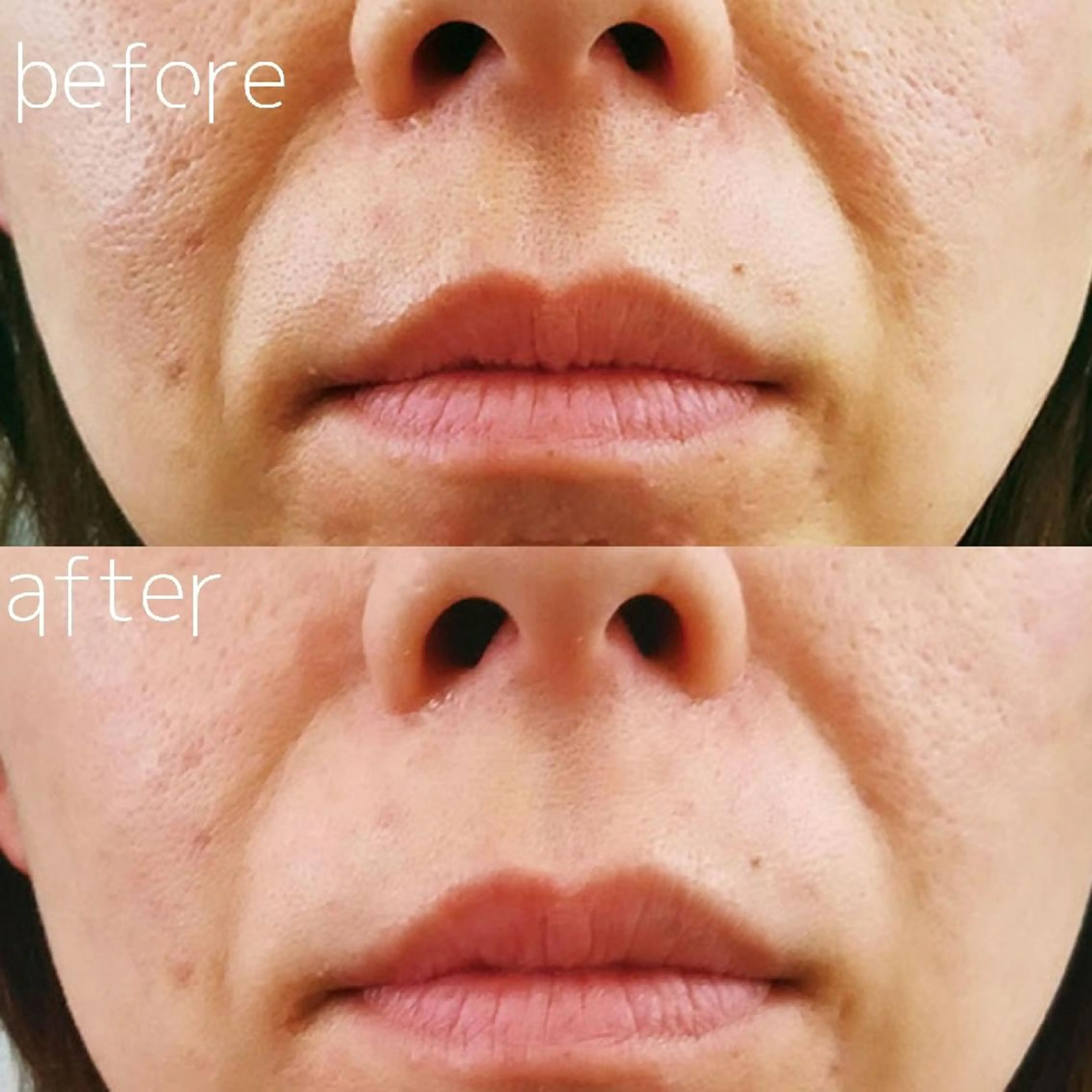 U_la所属・U_la [ウーラ] 片岡の眉毛・アイブロウイメージ