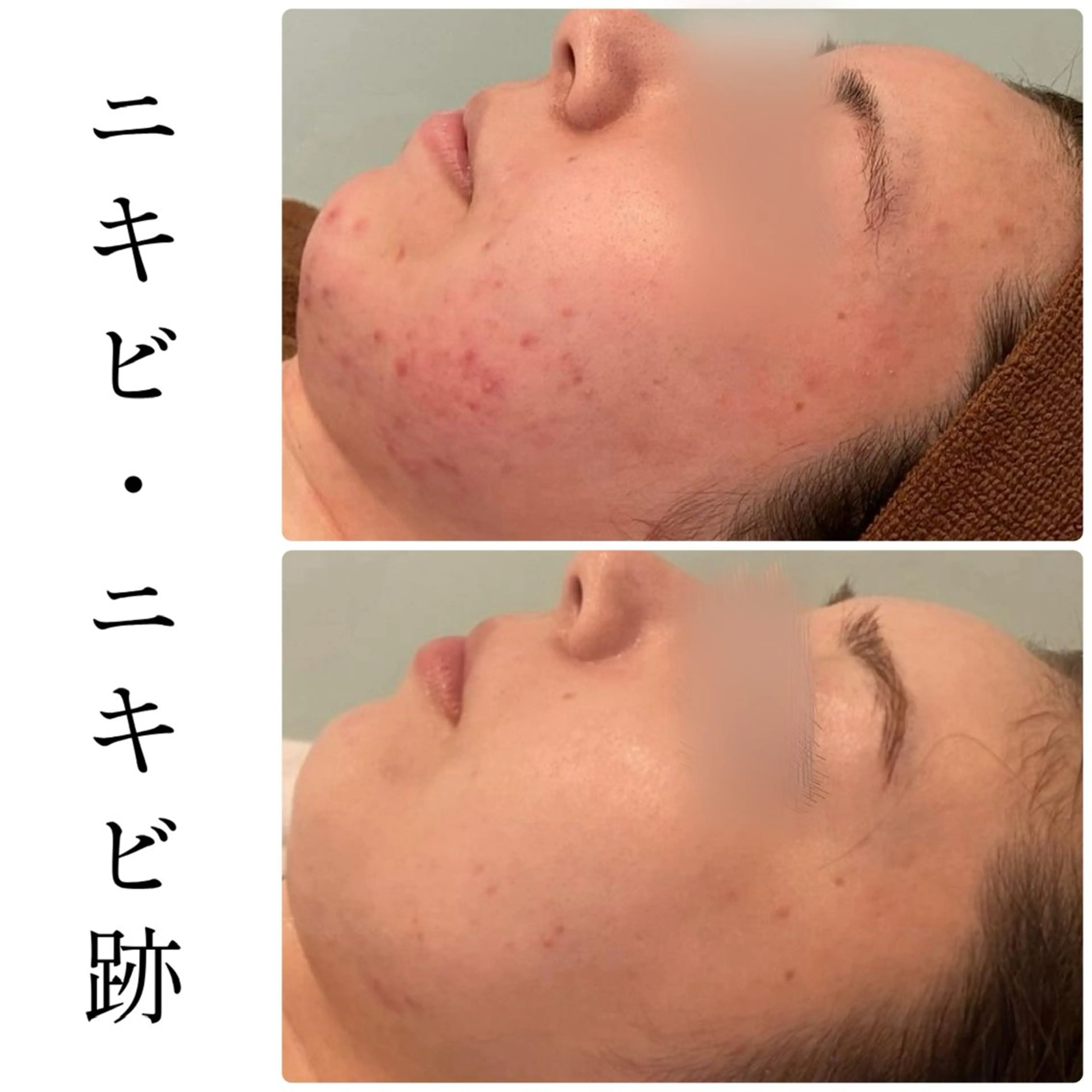 ハーブピーリング専門 BIOEL横浜のエステ・リラクイメージ