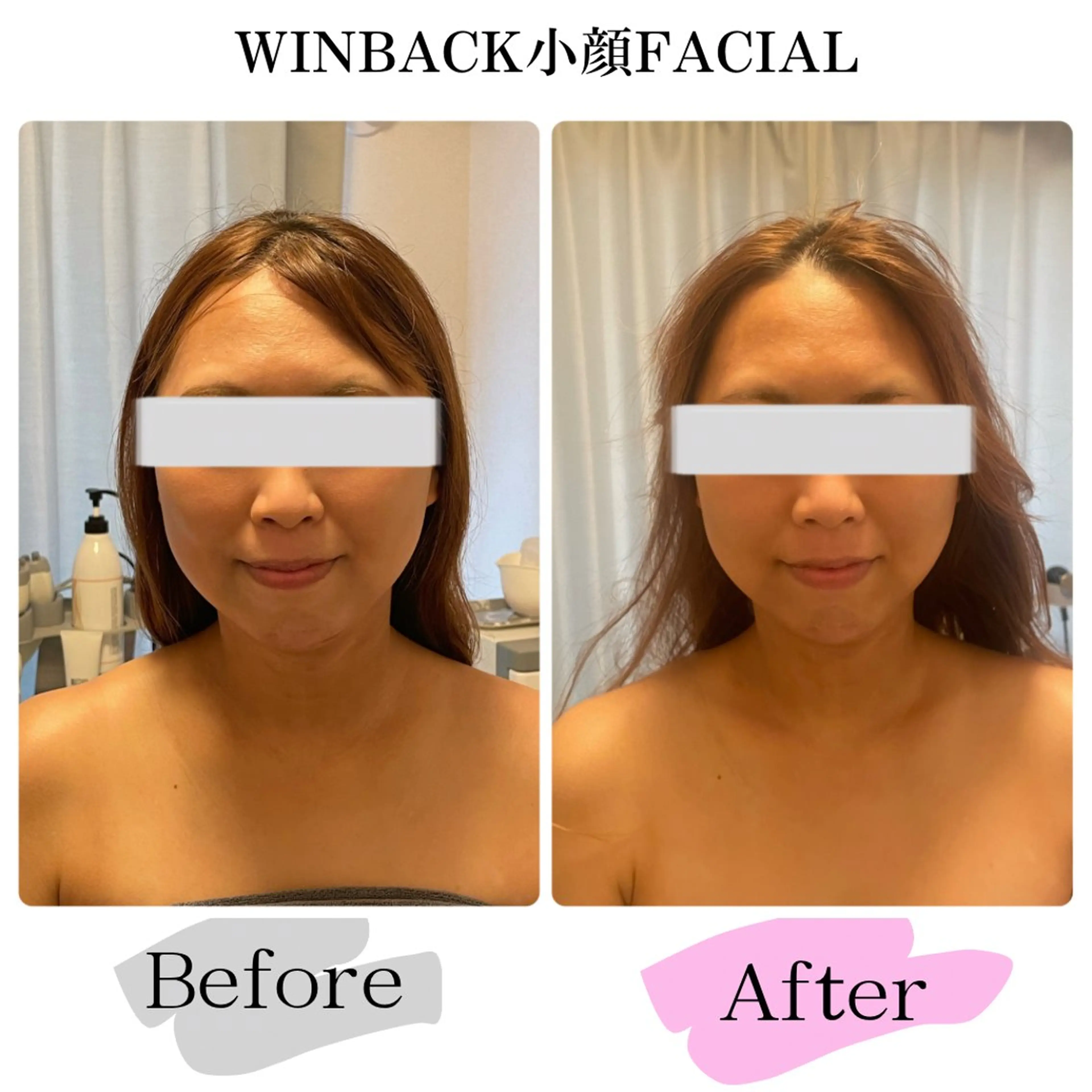 短時間でも効果有り♪アプリ要らずの小顔作り💓WINBACKオールハンドフェイシャル60分の写真