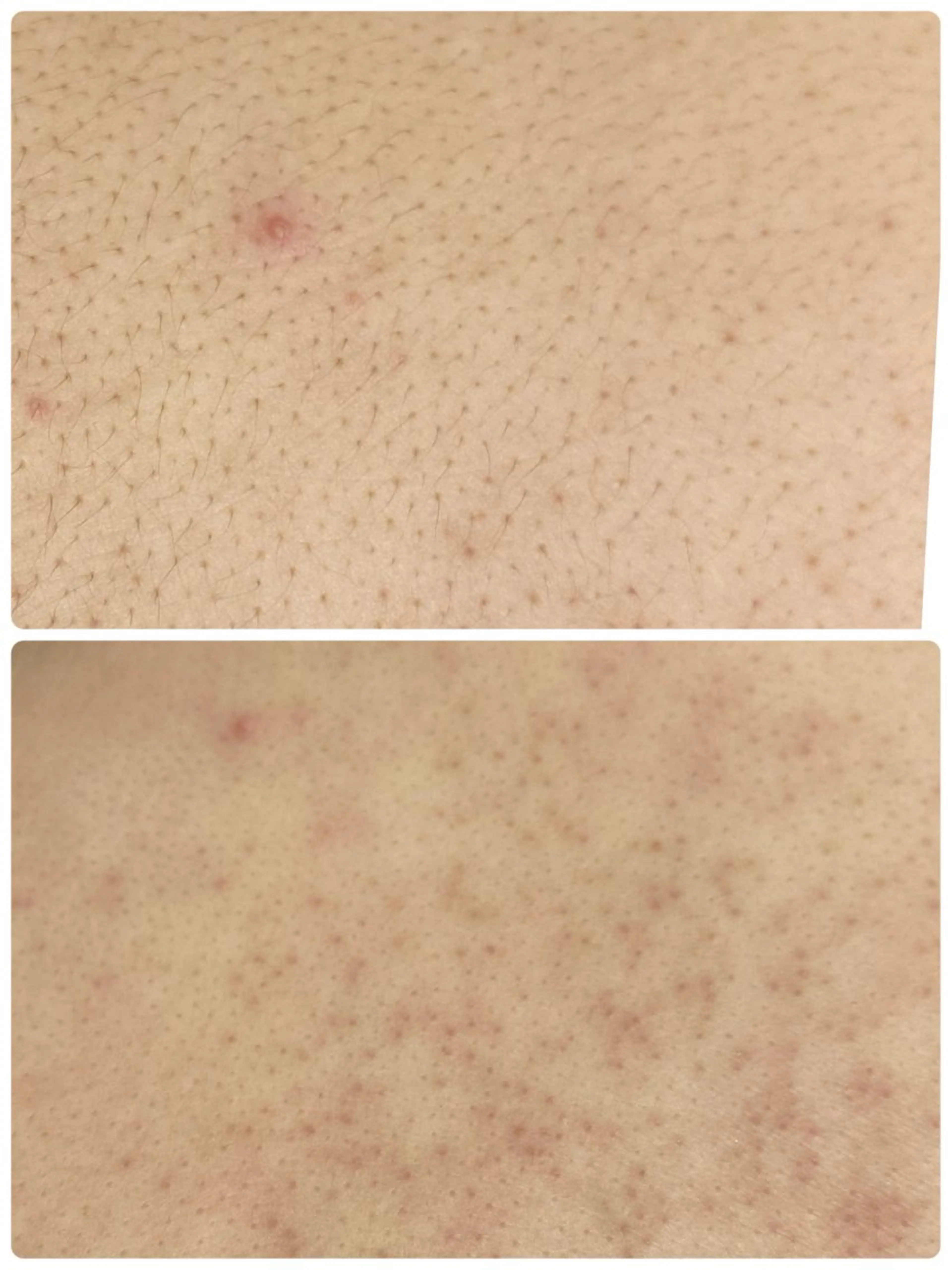 脱毛 シュガーリングサロン ダリア所属・Dahliaダリア シュガーリングサロンのエステ・リラクイメージ