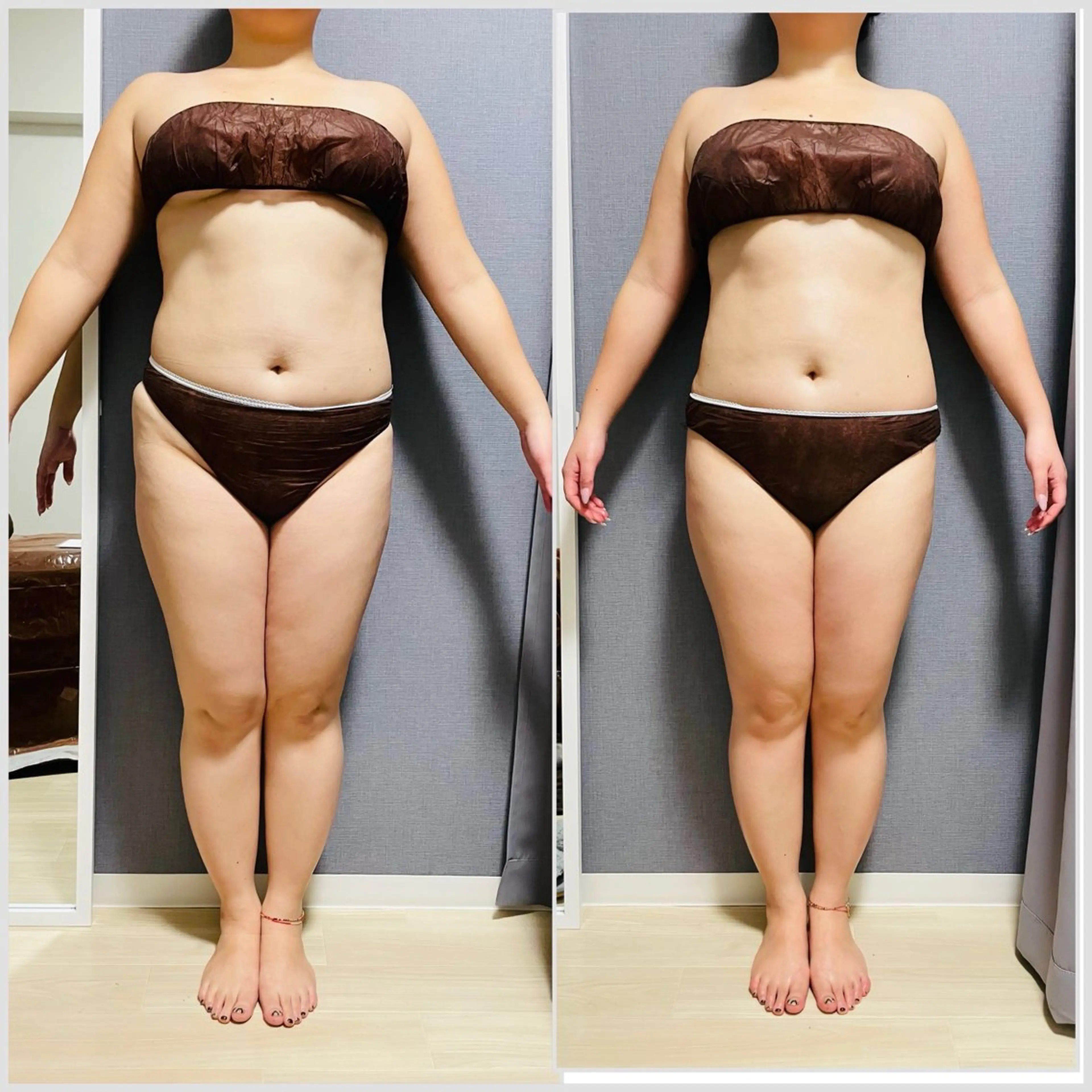 本気痩せ応援プラン｜結果重視の痩身体験コース60分の写真