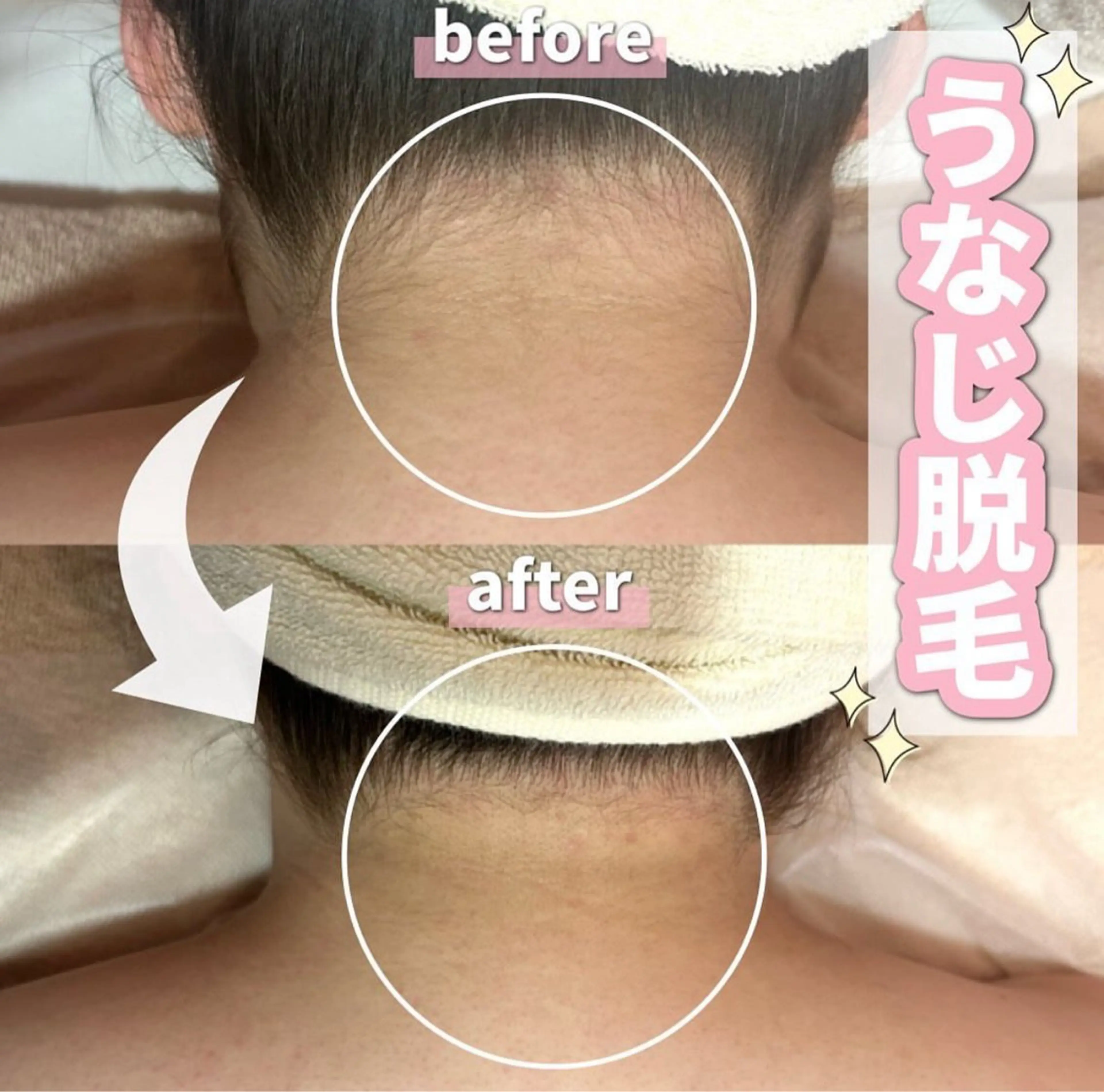 脱毛 SALON所属・SALON韓国肌管理 東別院のエステ・リラクイメージ