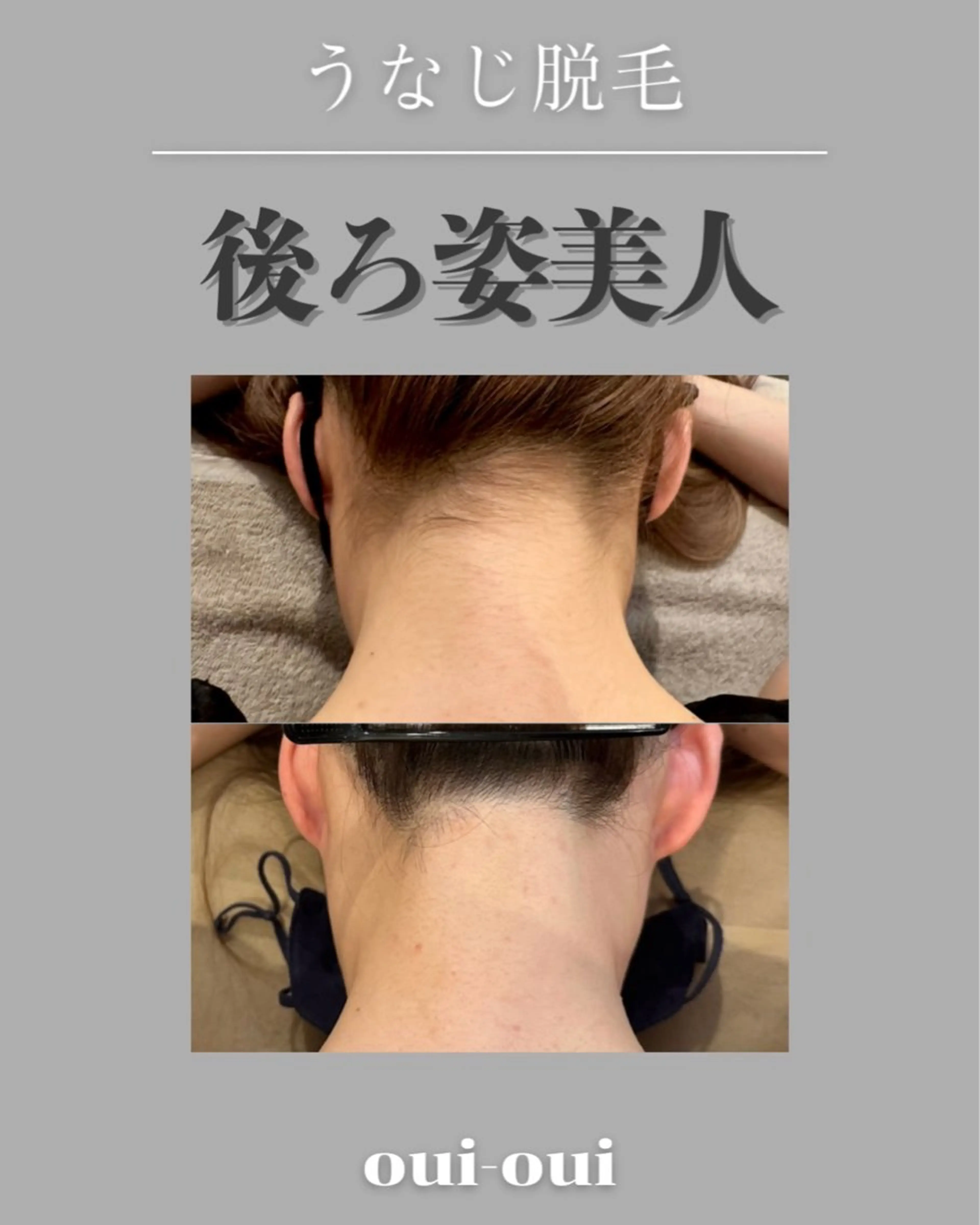 oui-oui　ウィウィ所属・oui-oui 磐田脱毛のエステ・リラクイメージ