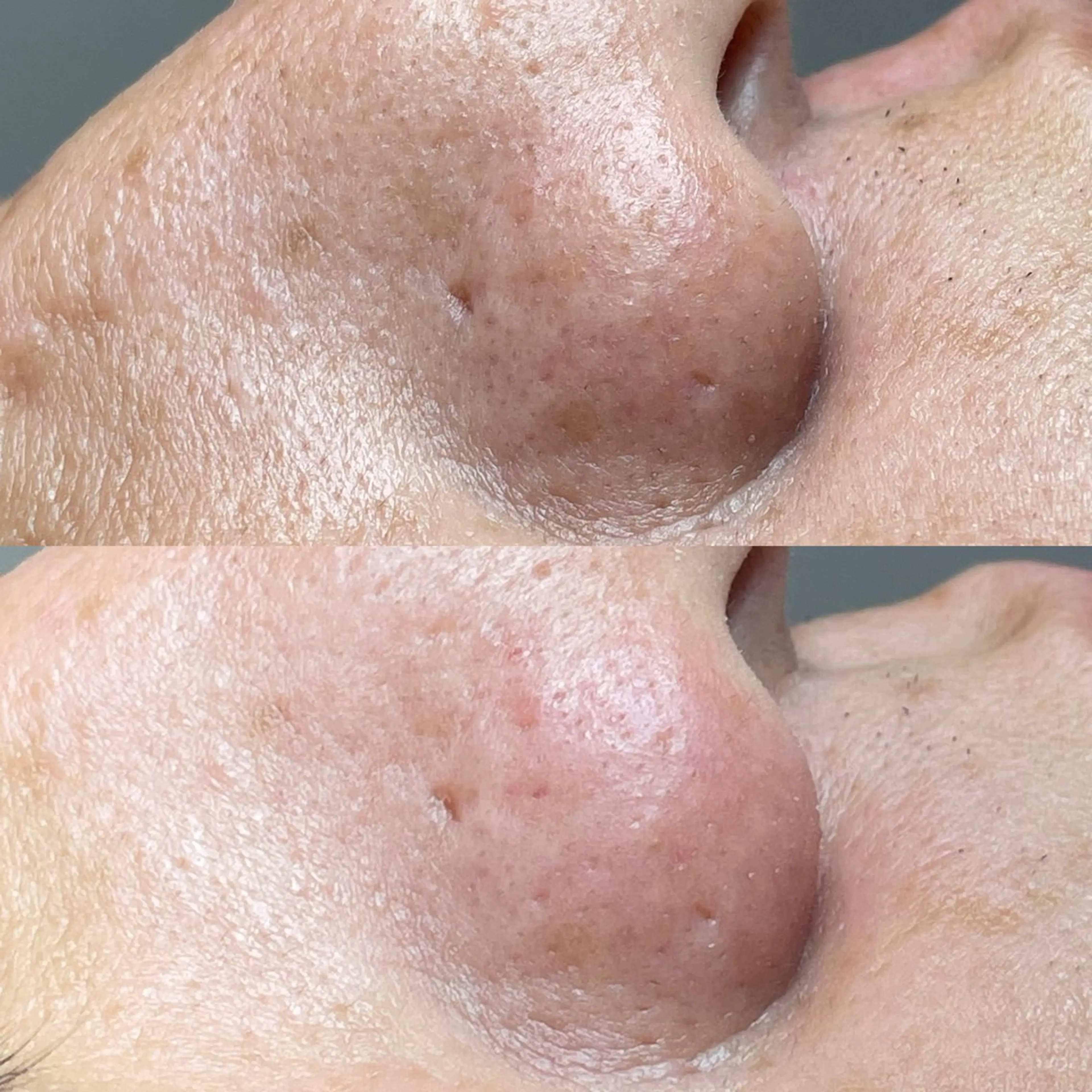 エステ リラク セルフエステエンリケ明石大久保店所属・夕希リンパ&痩身& 脱毛&毛穴ケアのエステ・リラクイメージ