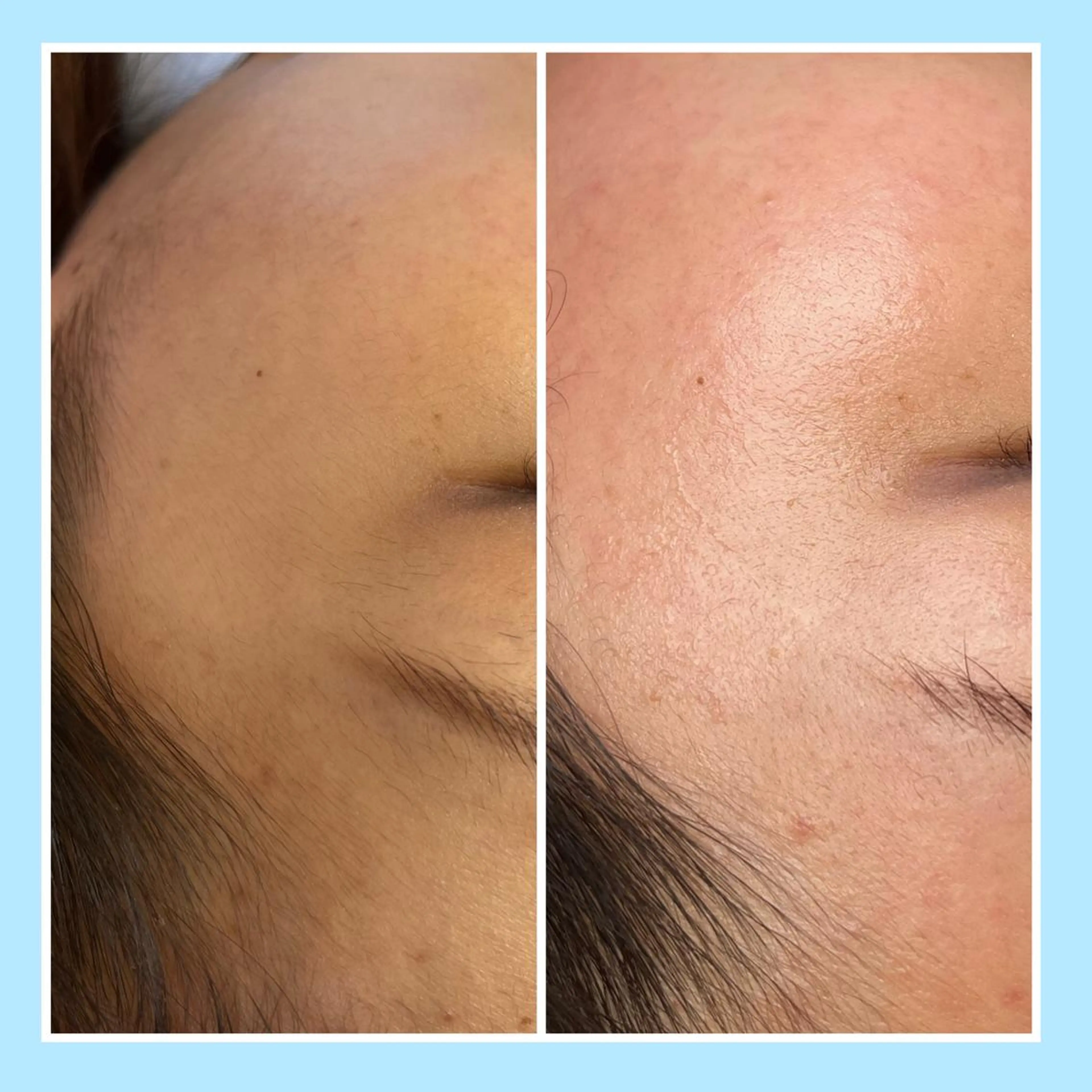 脱毛 🌊🌊__ juna__のマツエク・マツパデザイン