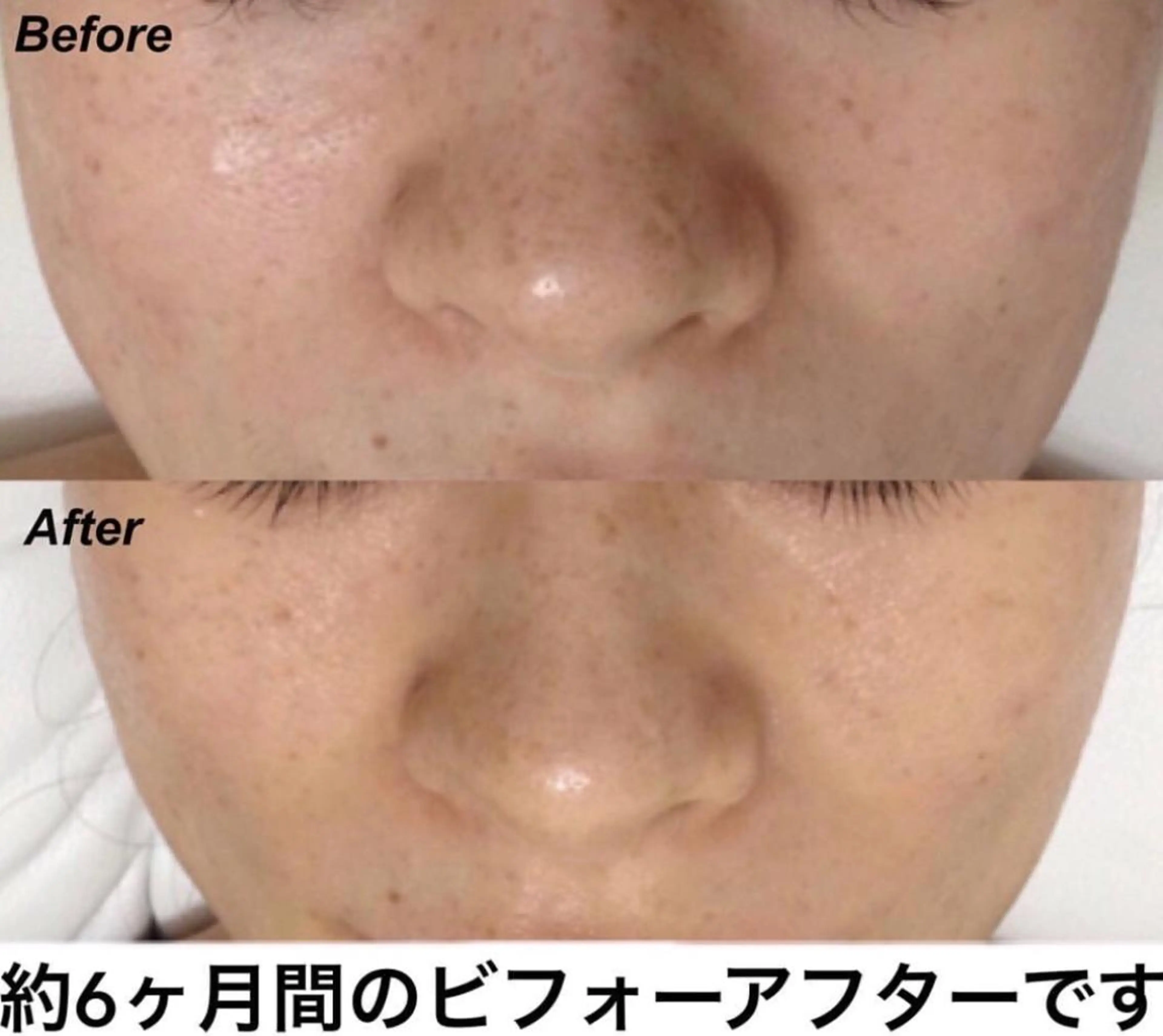 エステ リラク 都度払い肌質改善 &脱毛Blancheのエステ・リラクイメージ