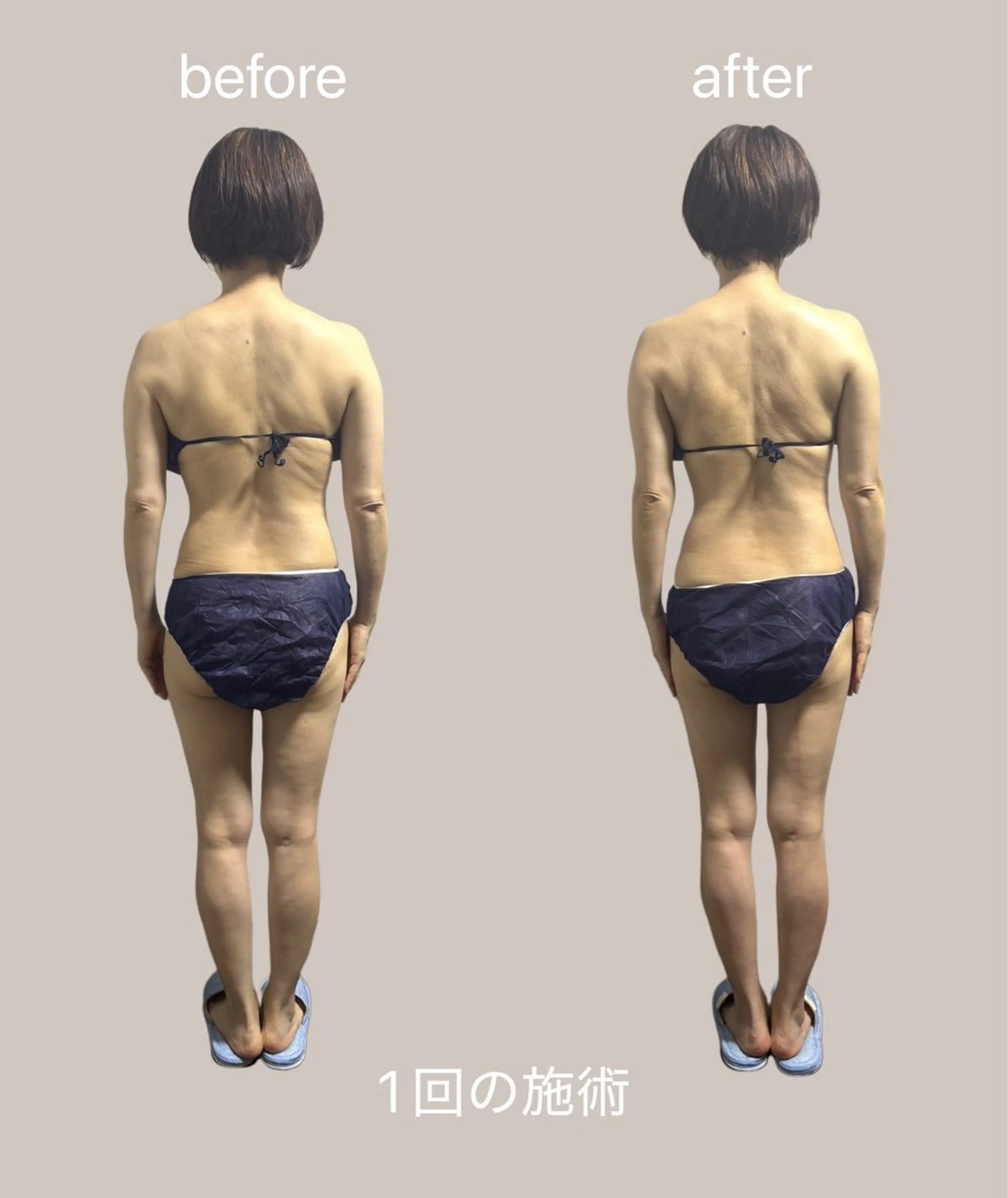 リラク arch所属・sasaki mihoのエステ・リラクイメージ