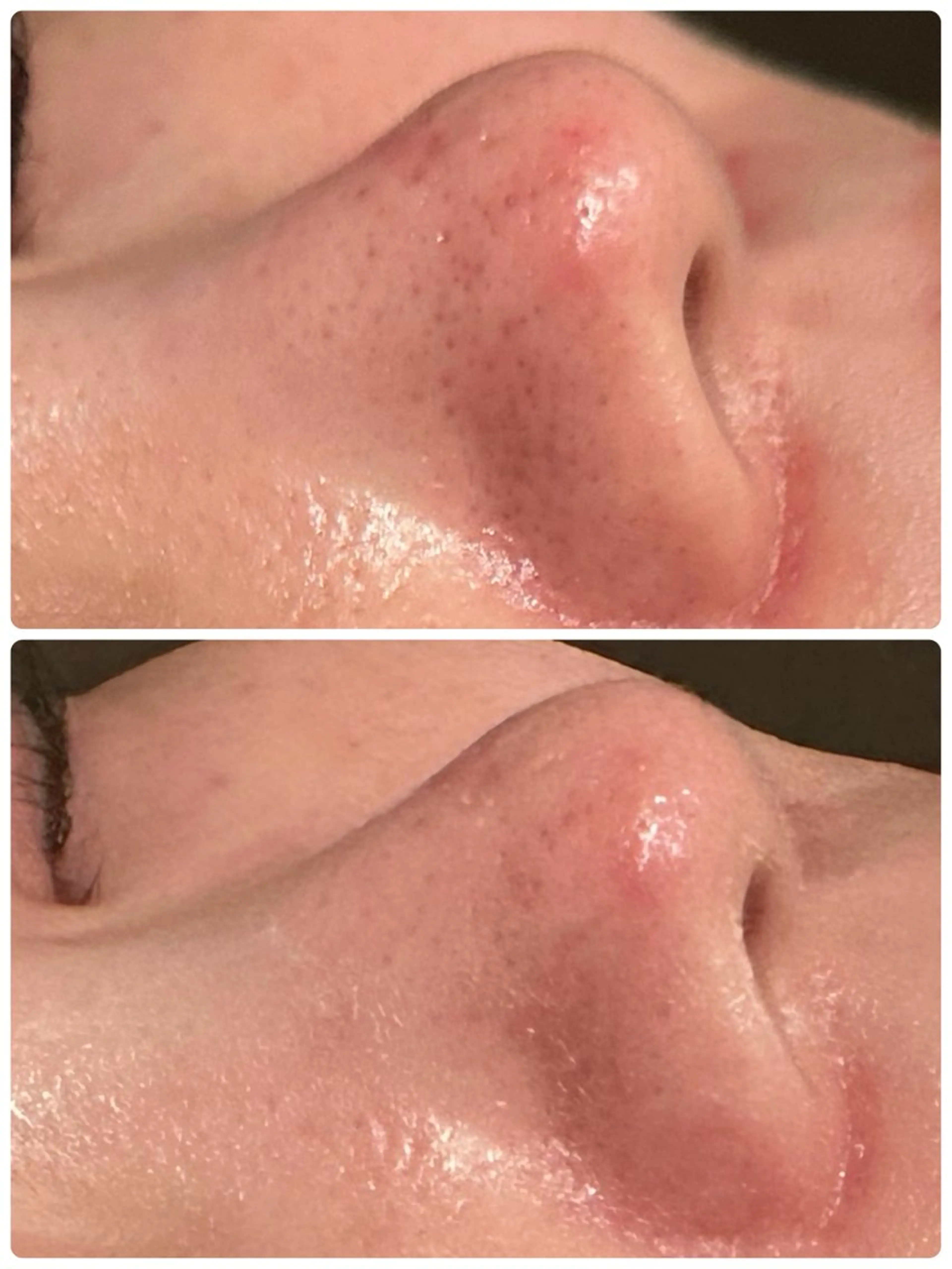 LaCachette ラカシェットのエステ・リラクイメージ