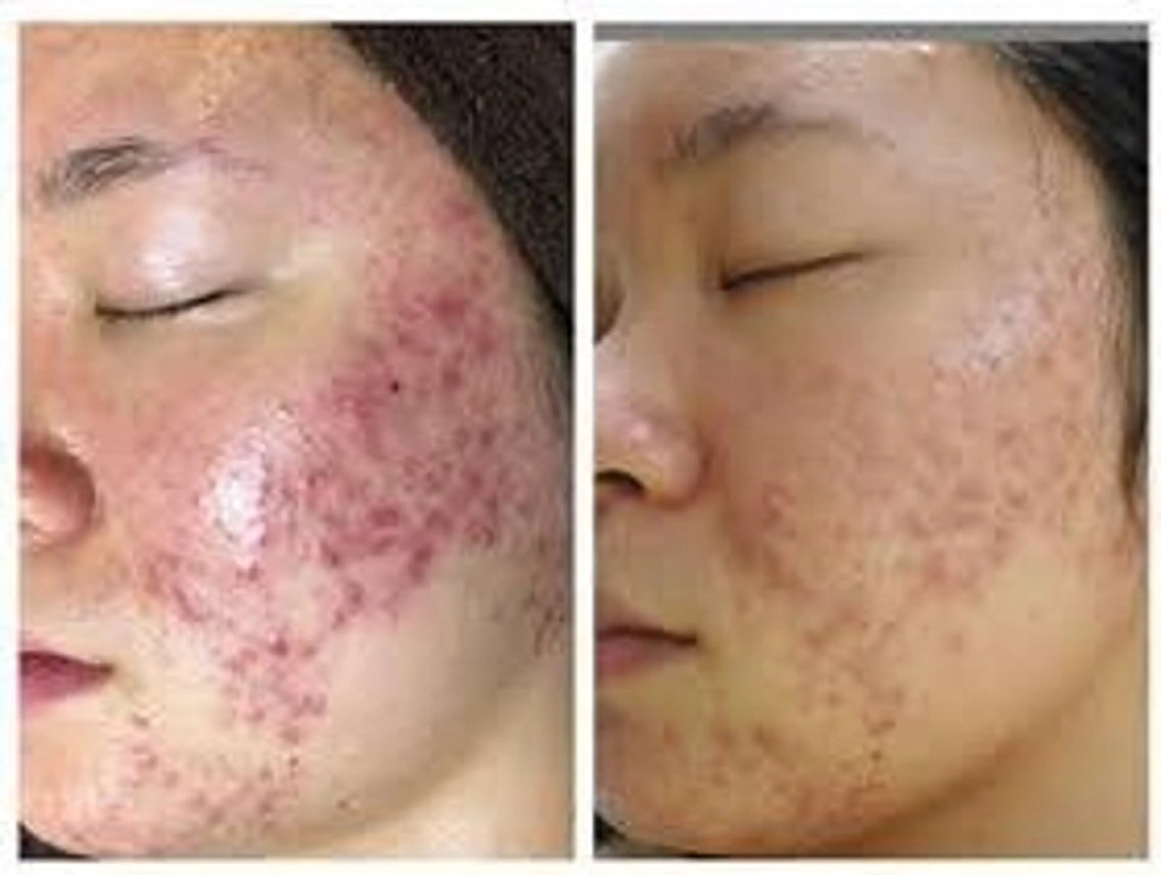 ほわいと あざぶのマツエク・マツパデザイン