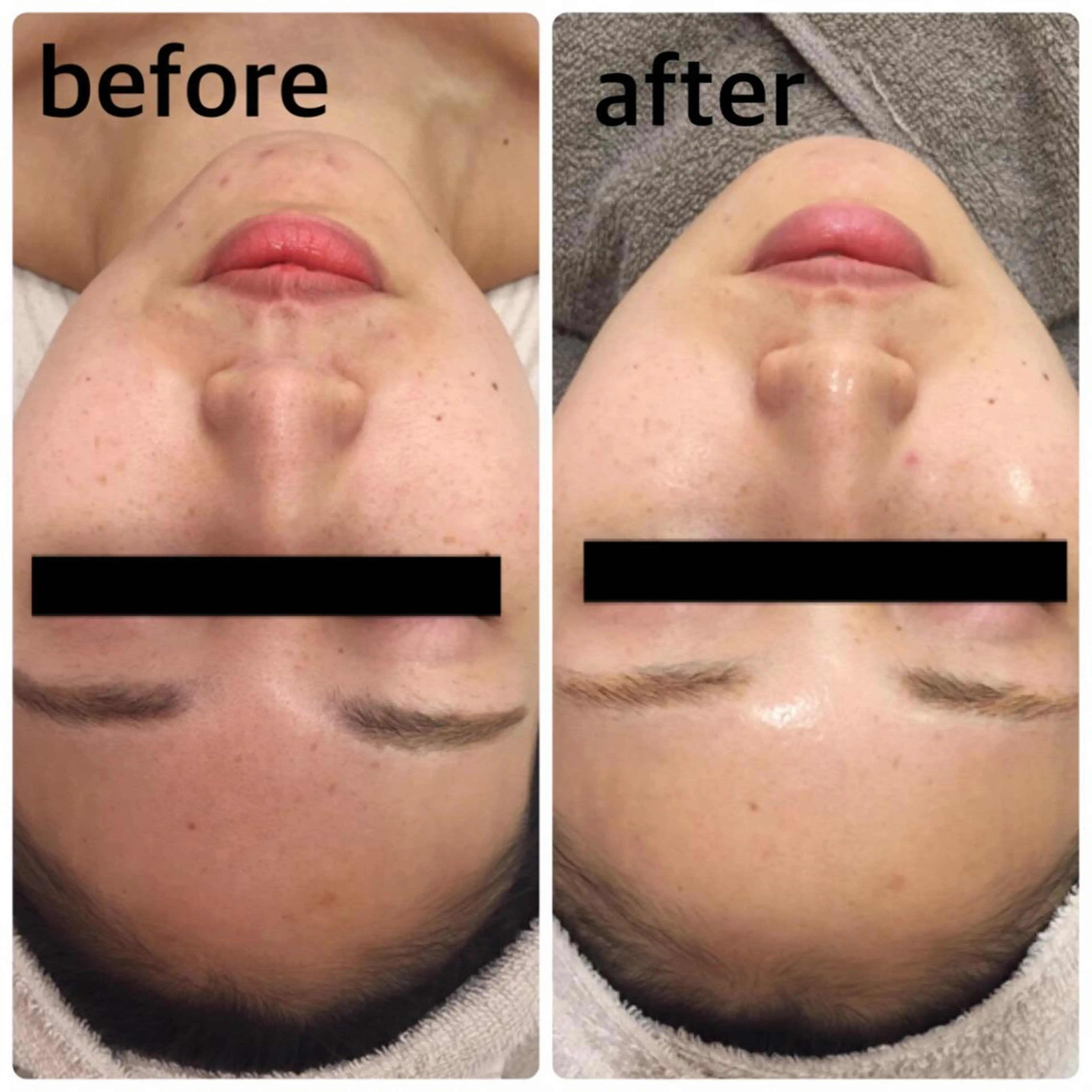 美肌脱毛・ハーブピーリング専門店Larin la beaute所属・Larin la beauteのエステ・リラクイメージ