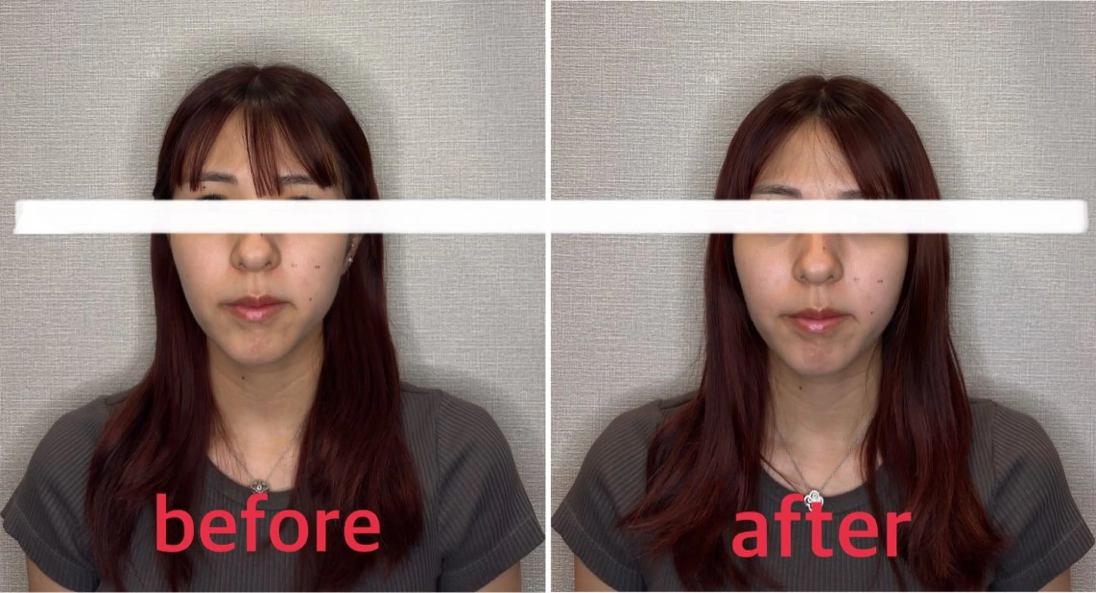 エステ リラク 小林整骨院本町 美容鍼roomのエステ・リラクイメージ