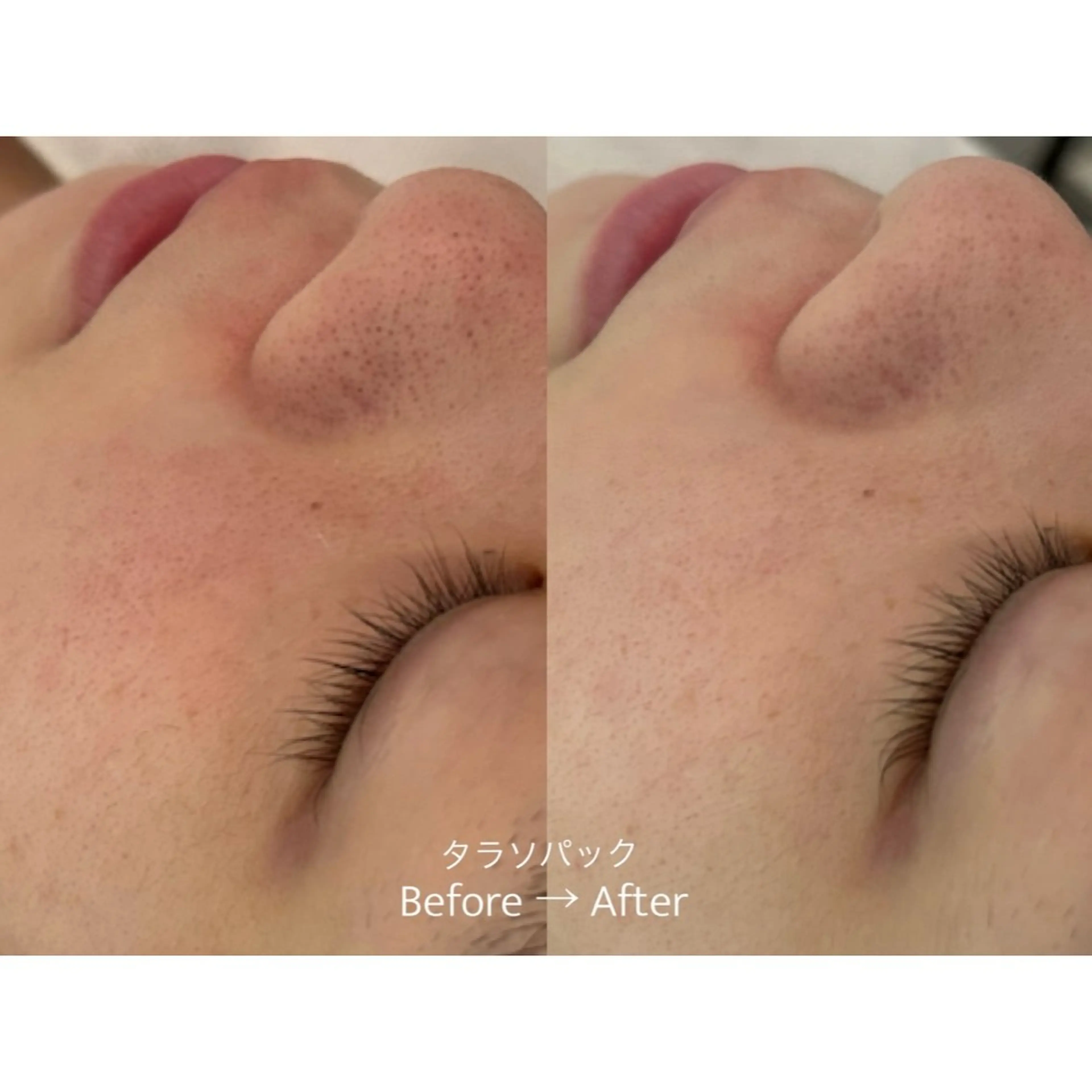 エステ リラク 杉浦里沙⌇ 居心地いいエステのエステ・リラクイメージ