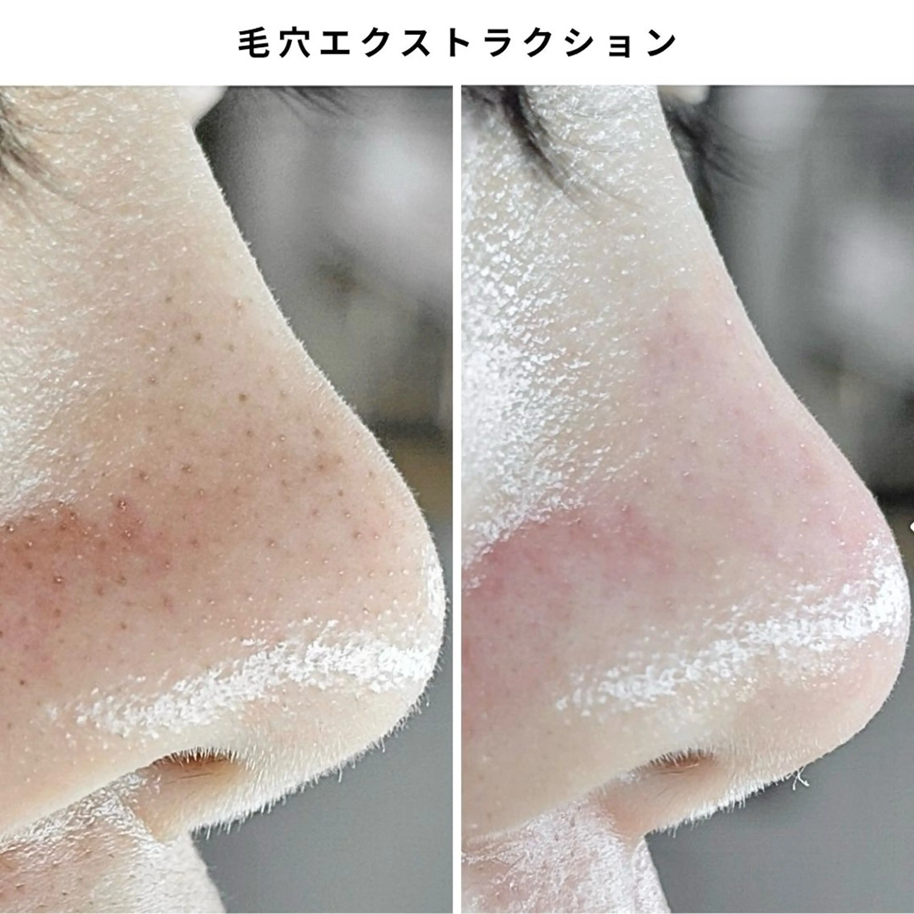 エステ Muqu.所属・Muqu. 毛穴サロンのエステ・リラクイメージ