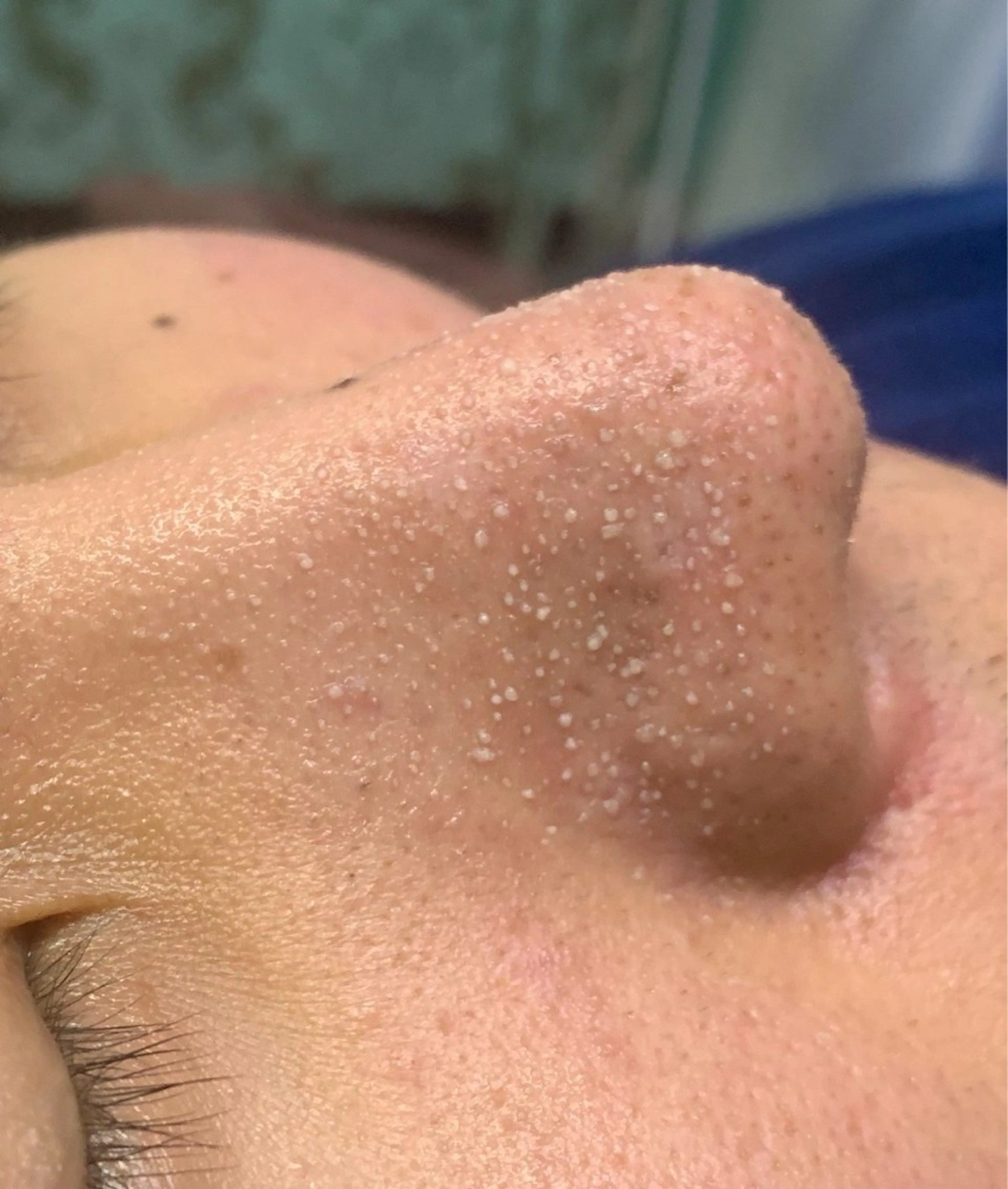 エステ フェイシャル/脱毛 ジョアアンジェ　田中のエステ・リラクイメージ