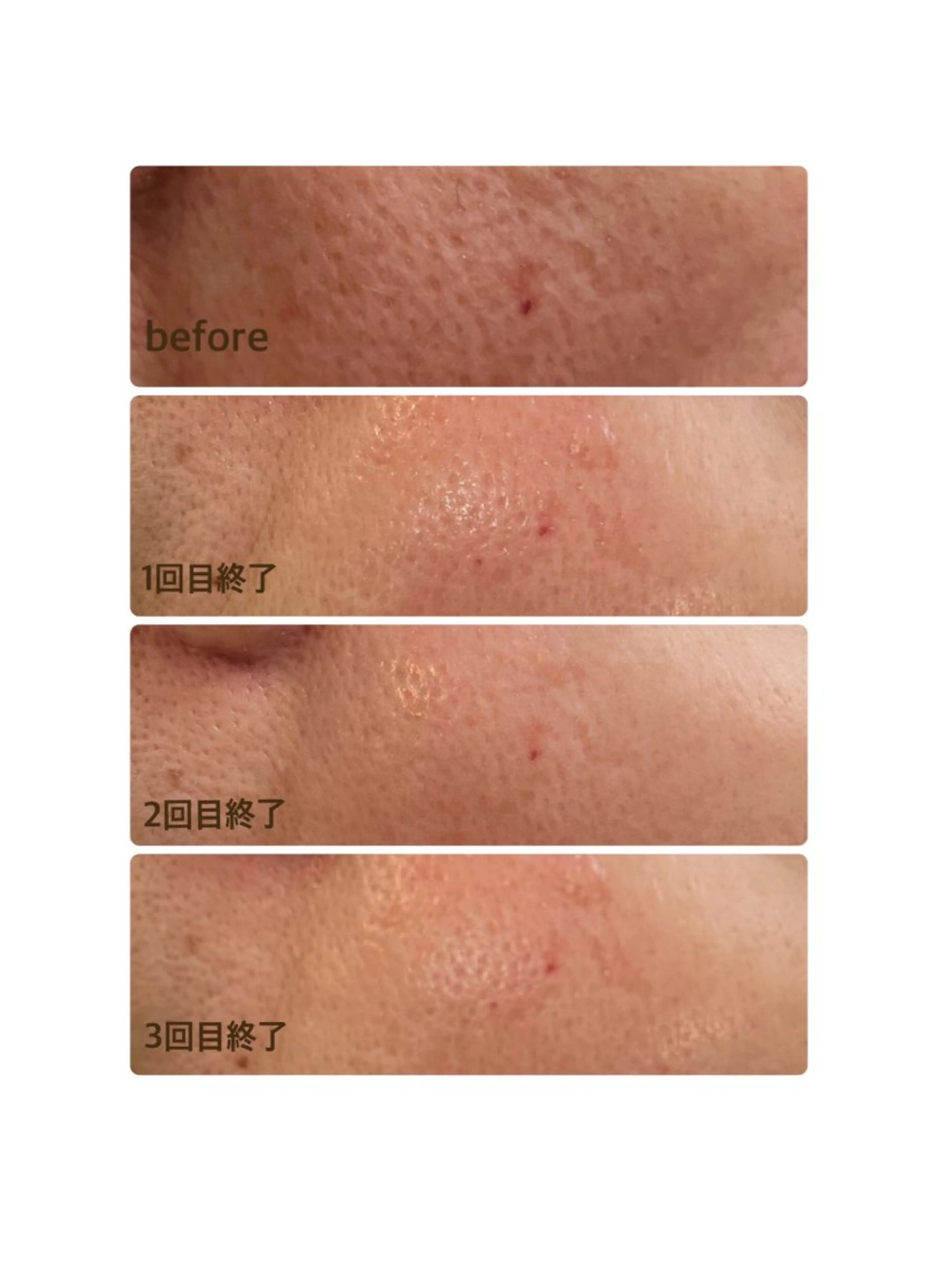 温活美肌専門サロン Lien『リアン』のエステ・リラクイメージ