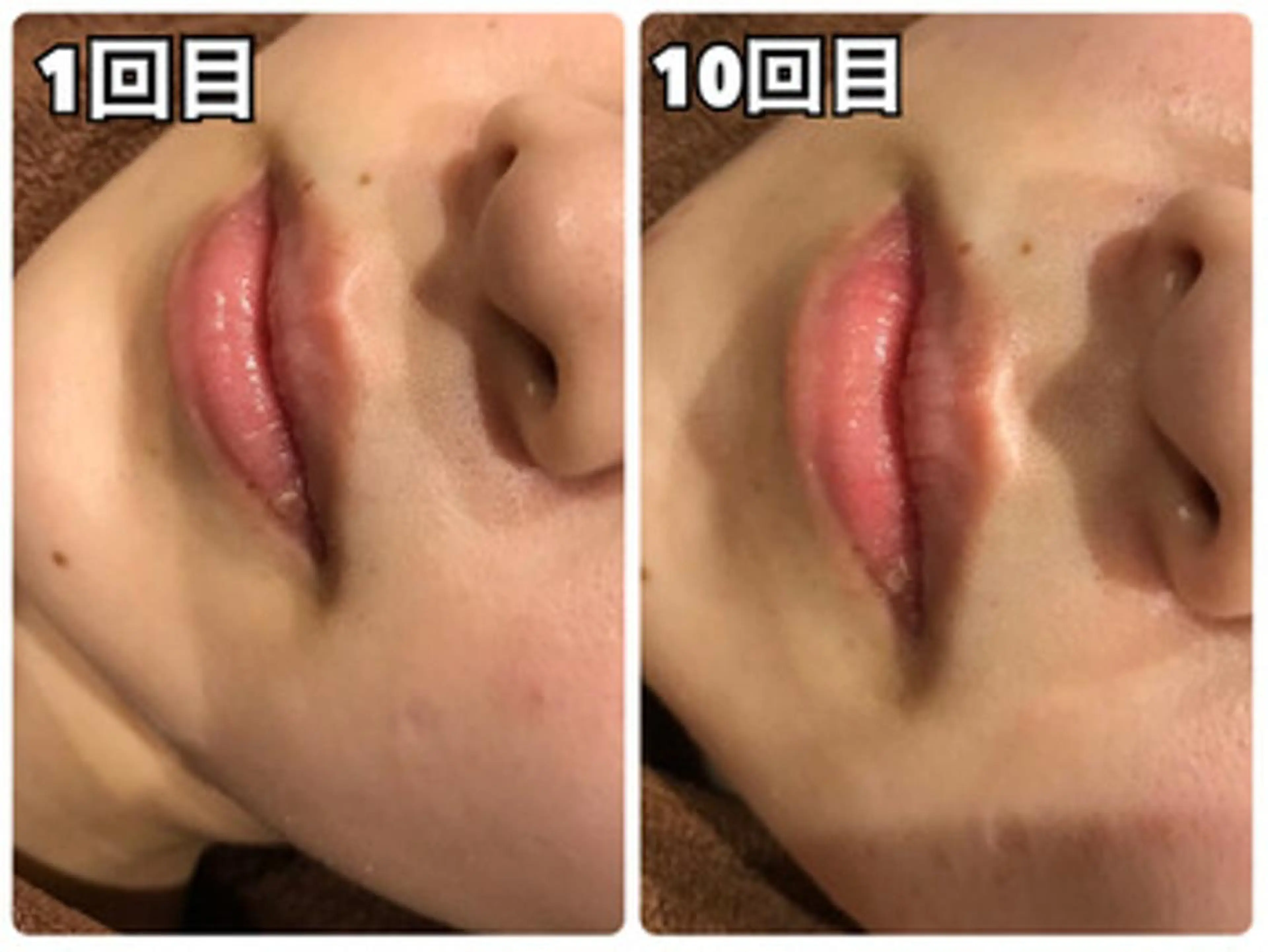 美肌脱毛専門店 ディオーネ四日市店のエステ・リラクイメージ