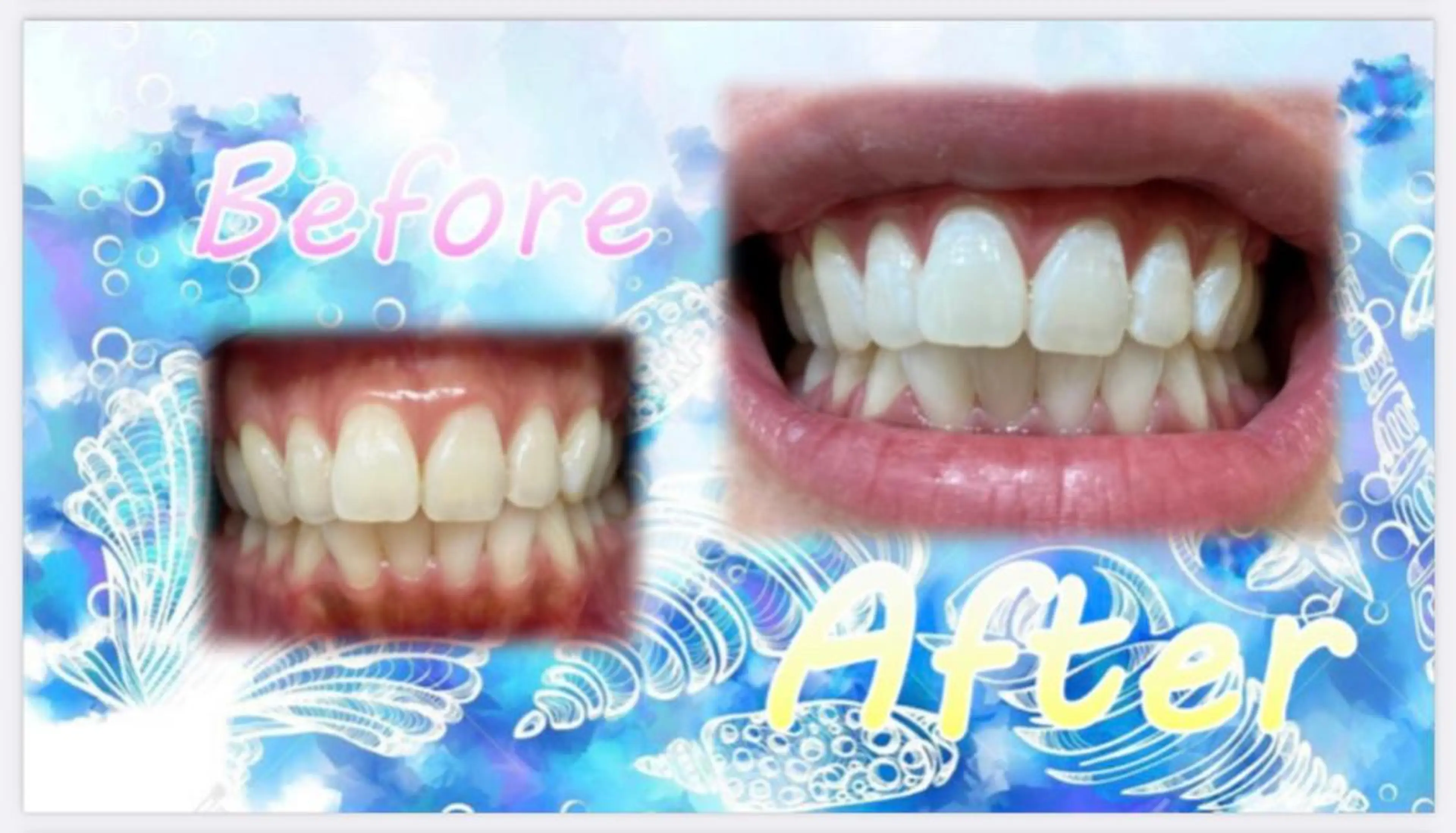 その他 セルフホワイトニングサロン　ラヴィアン所属・ホワイトニングサロン La vie enのその他イメージ