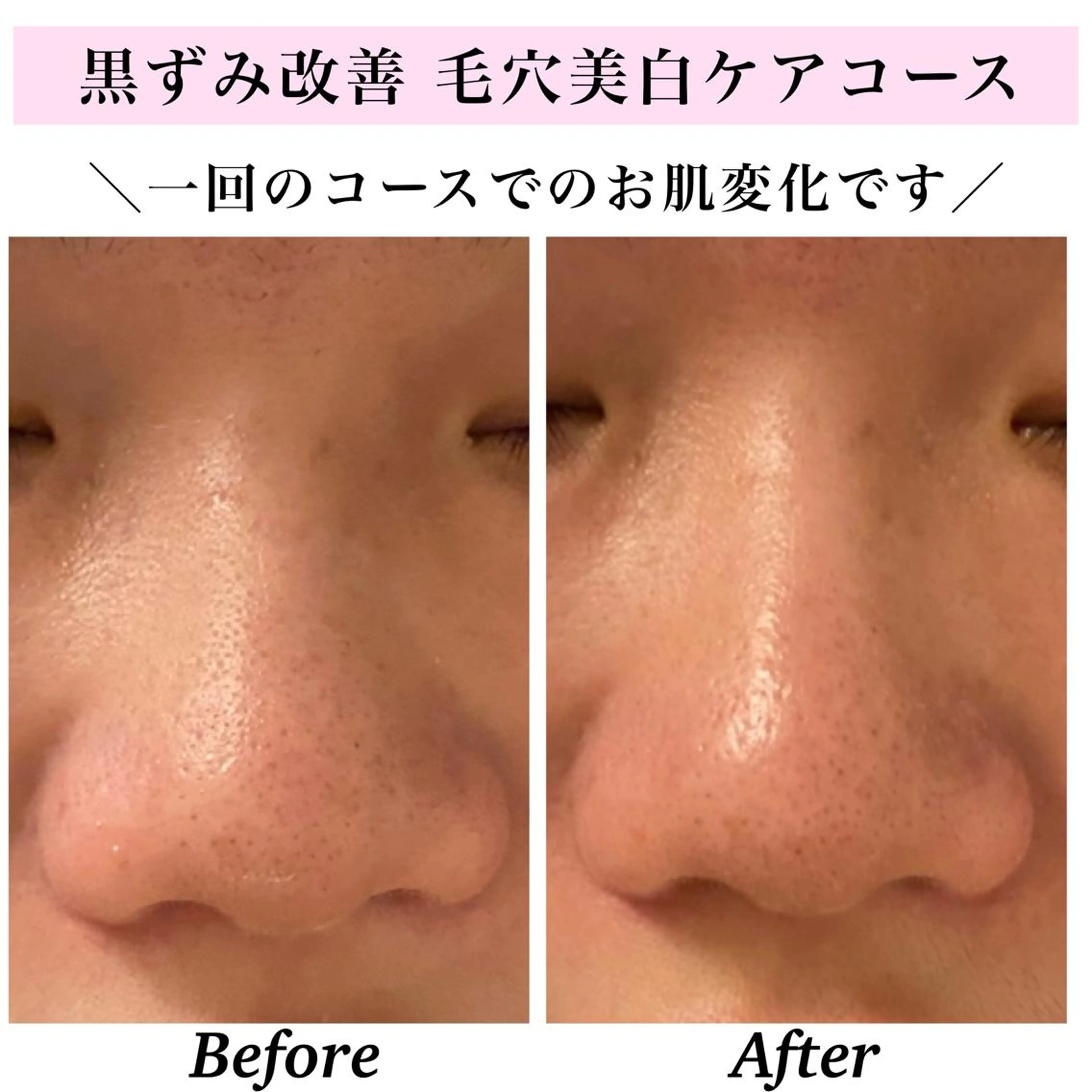 エステ リラク Bellesthe （ベルエステ）のエステ・リラクイメージ