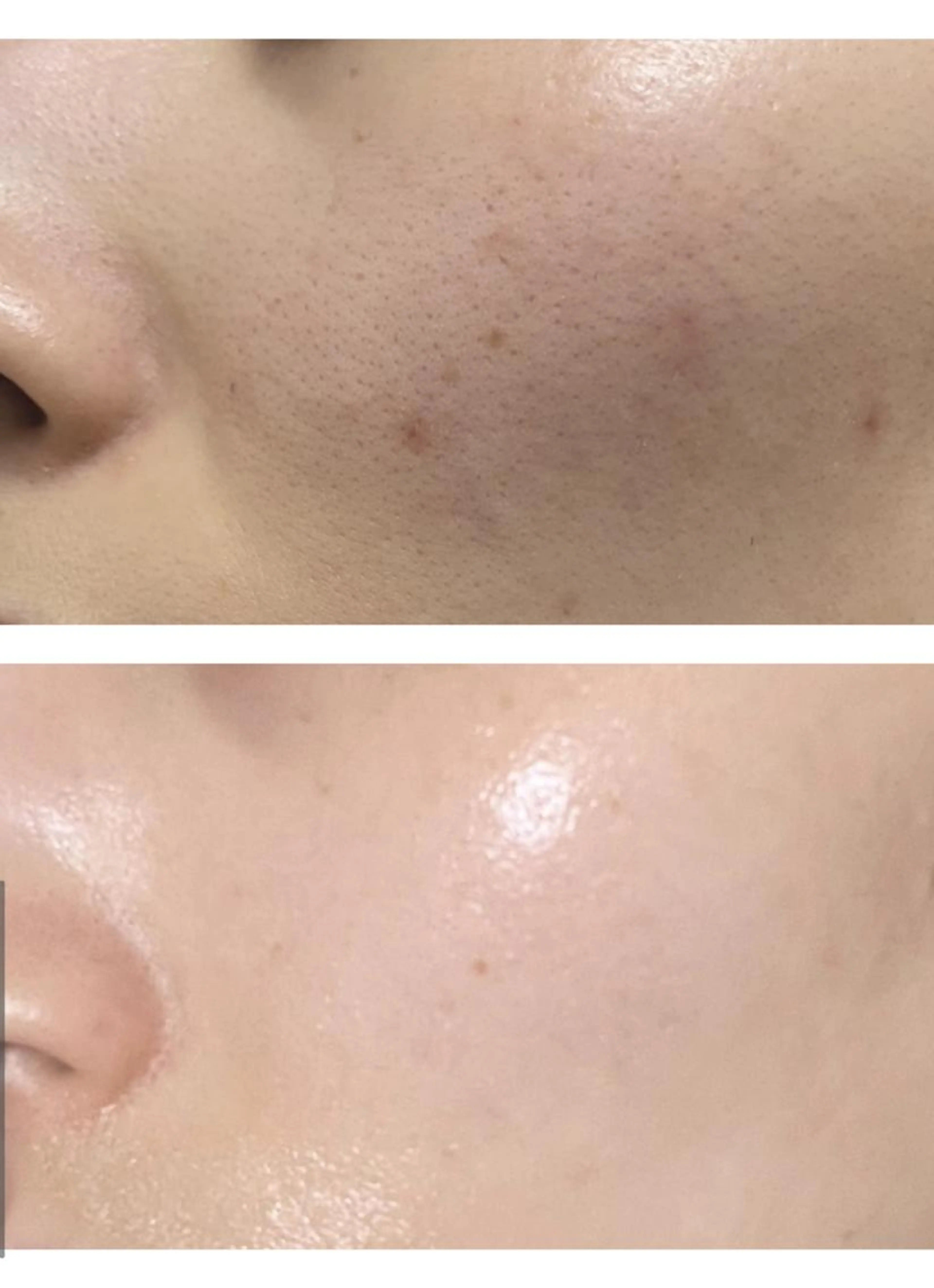 12月限定❄️雪のような透明感❄️【美白特化】シミくすみ徹底改善✨DNAレベルの改善でゆらがない肌へ😳の写真