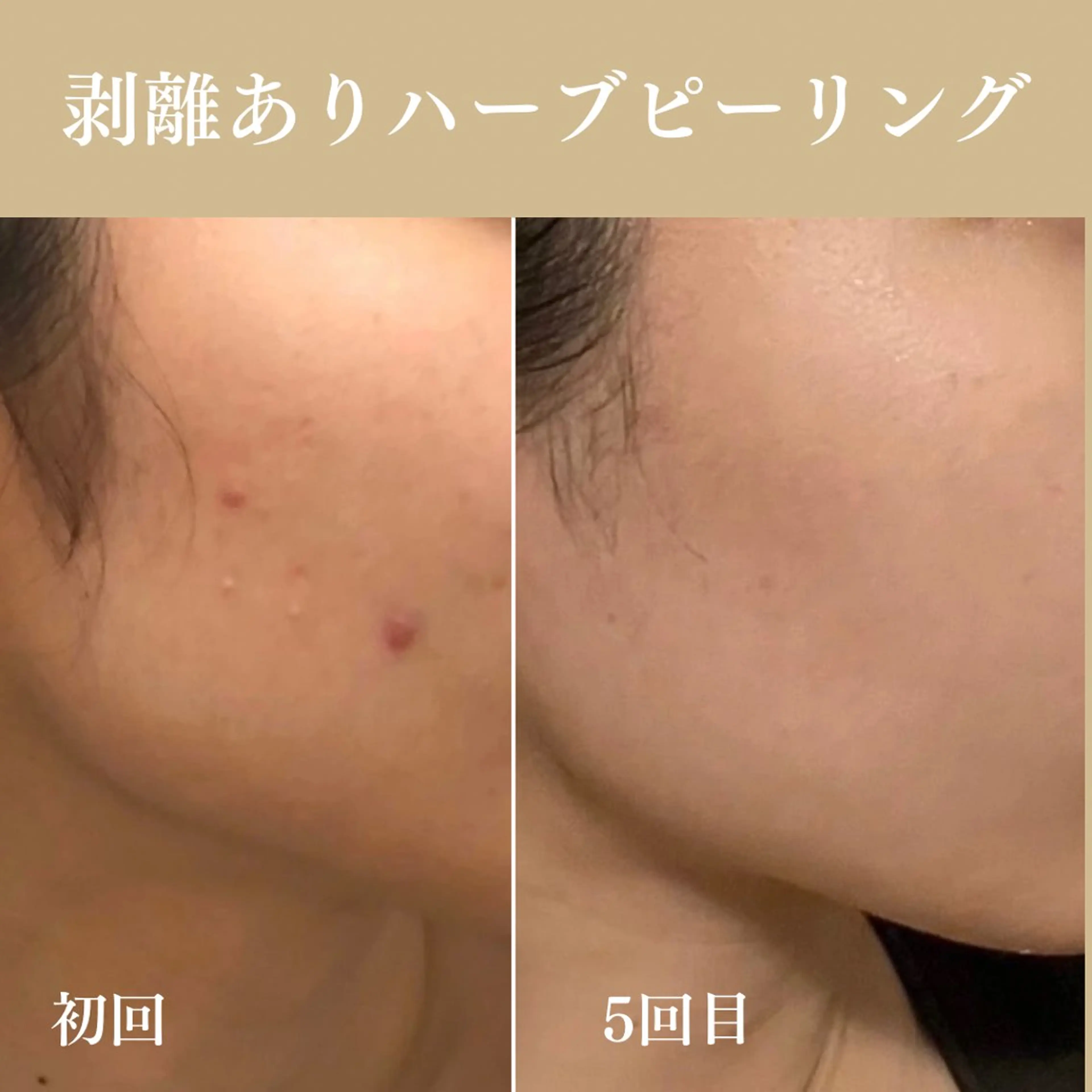 Oncebell. Bodymake&beautysalon所属・Oncebell. ワンベルのエステ・リラクイメージ