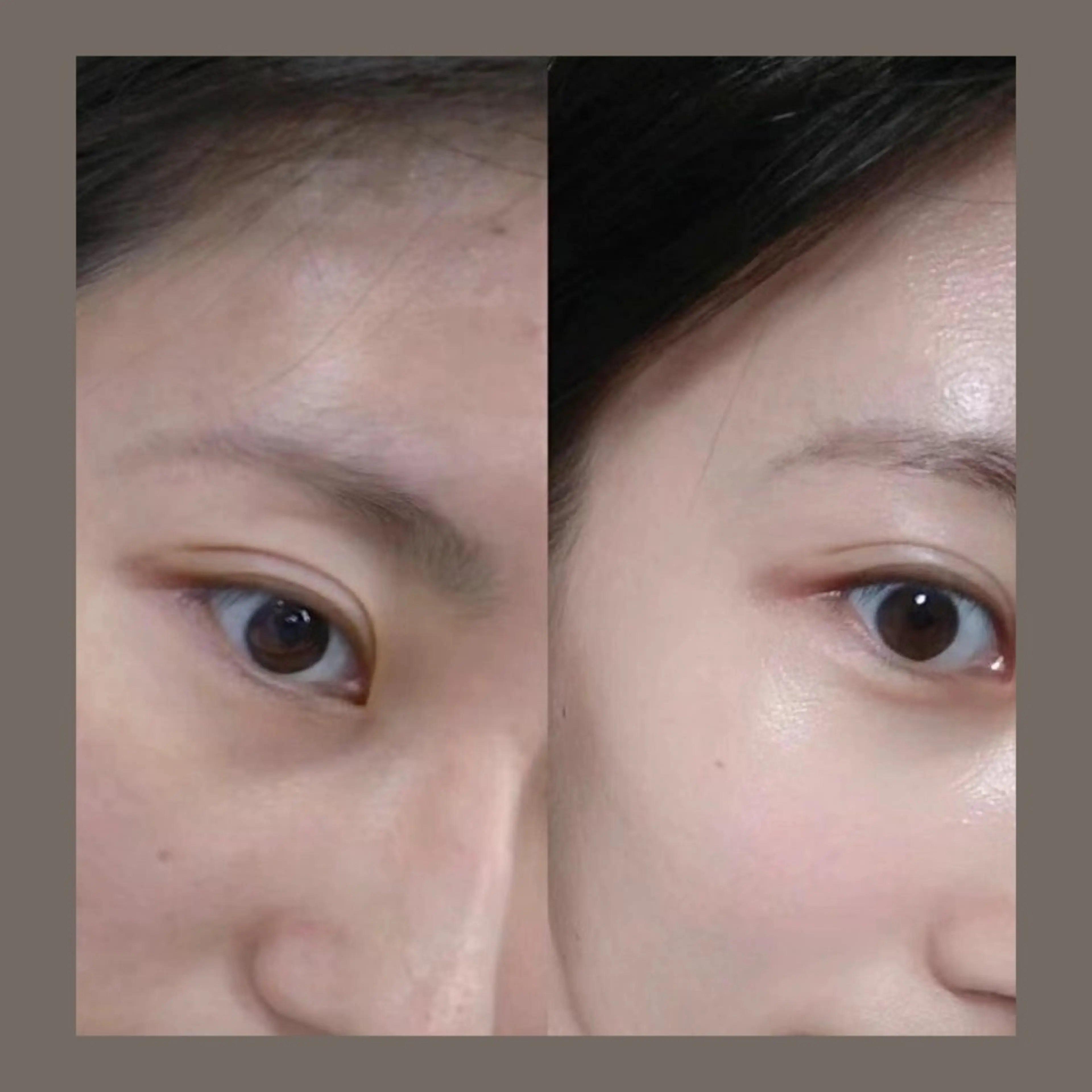 エステ リラク 愛維美水光美肌専門店所属・愛維美水光美肌専門店 メンズレディースokのエステ・リラクイメージ