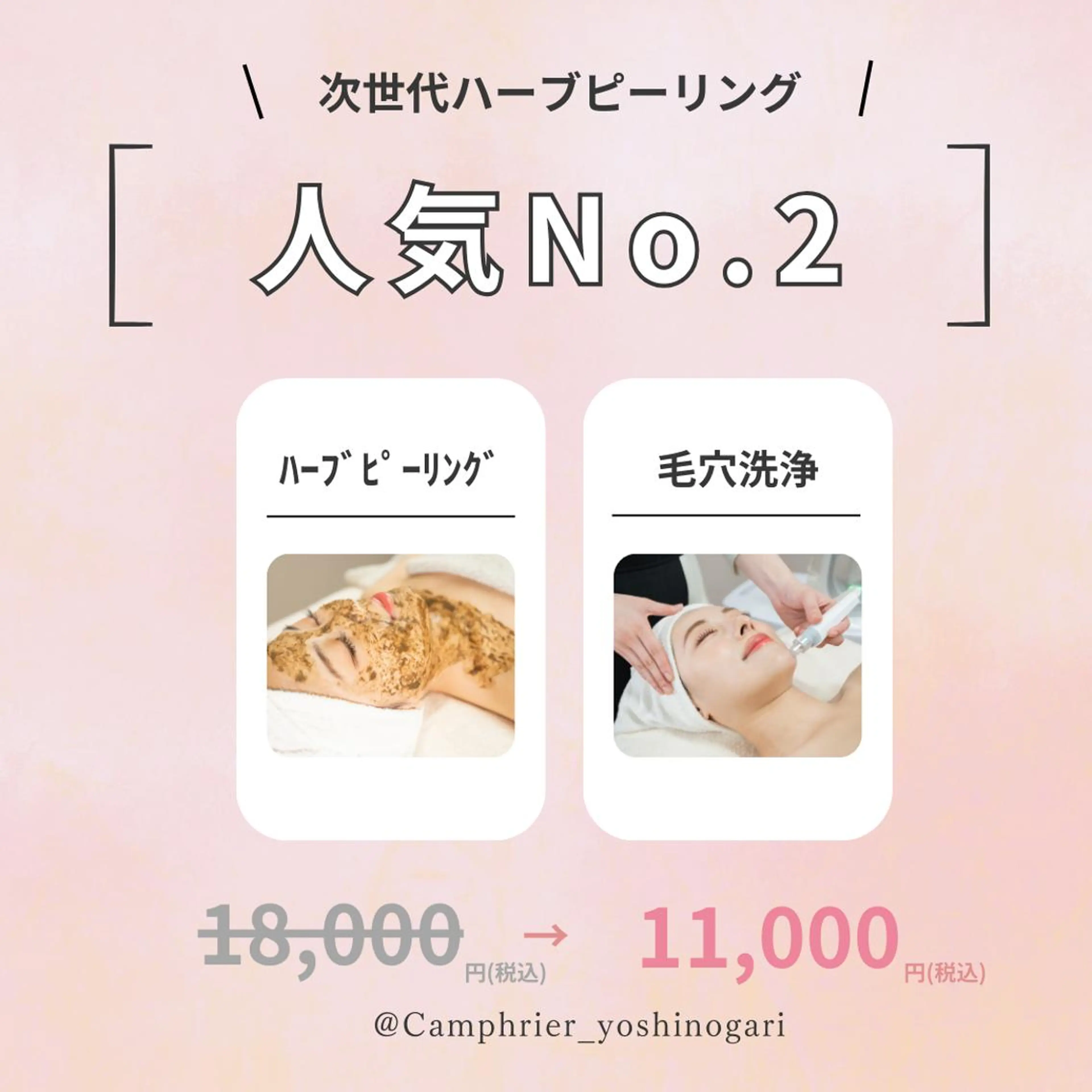 次世代★ハーブピーリング💎￥18000→￥11000の写真